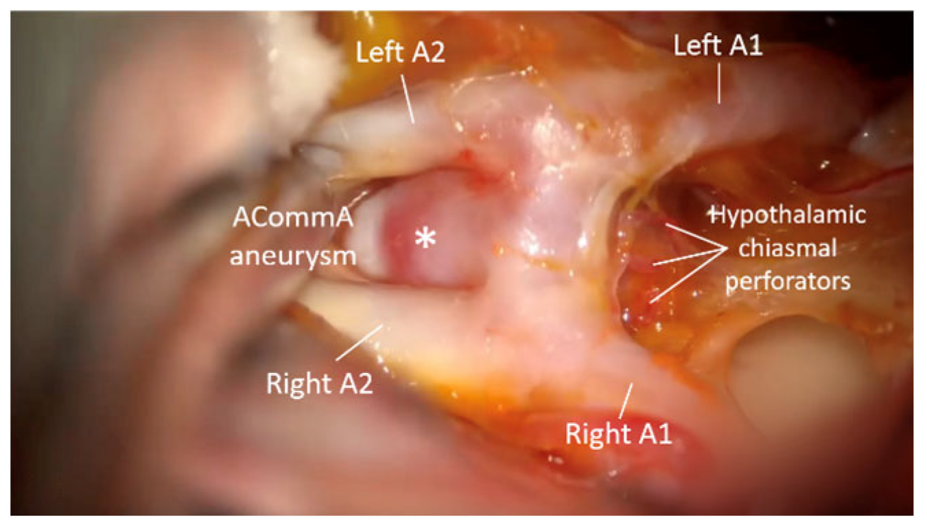 Brainsci 15 00300 g006