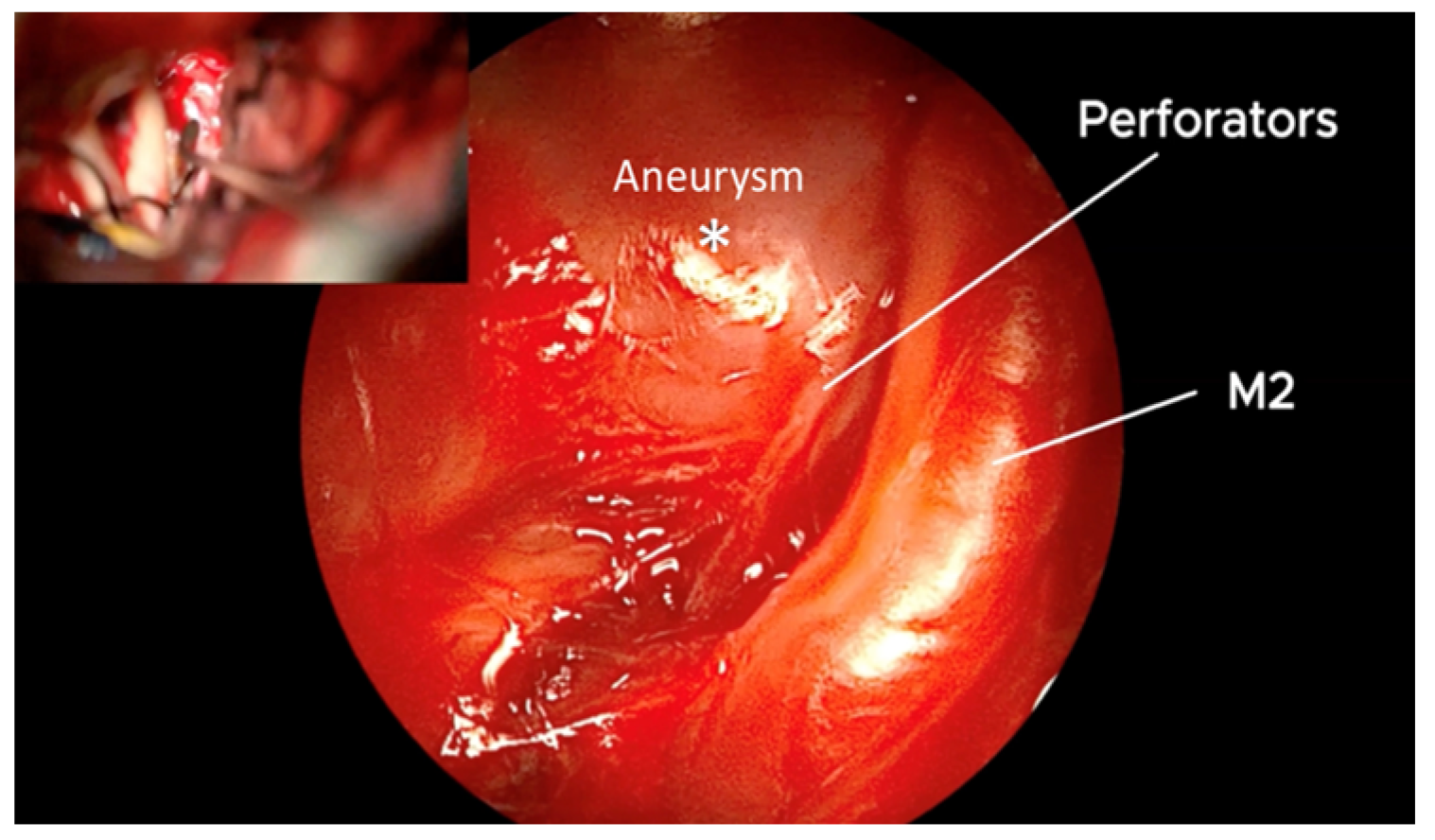 Brainsci 15 00300 g008
