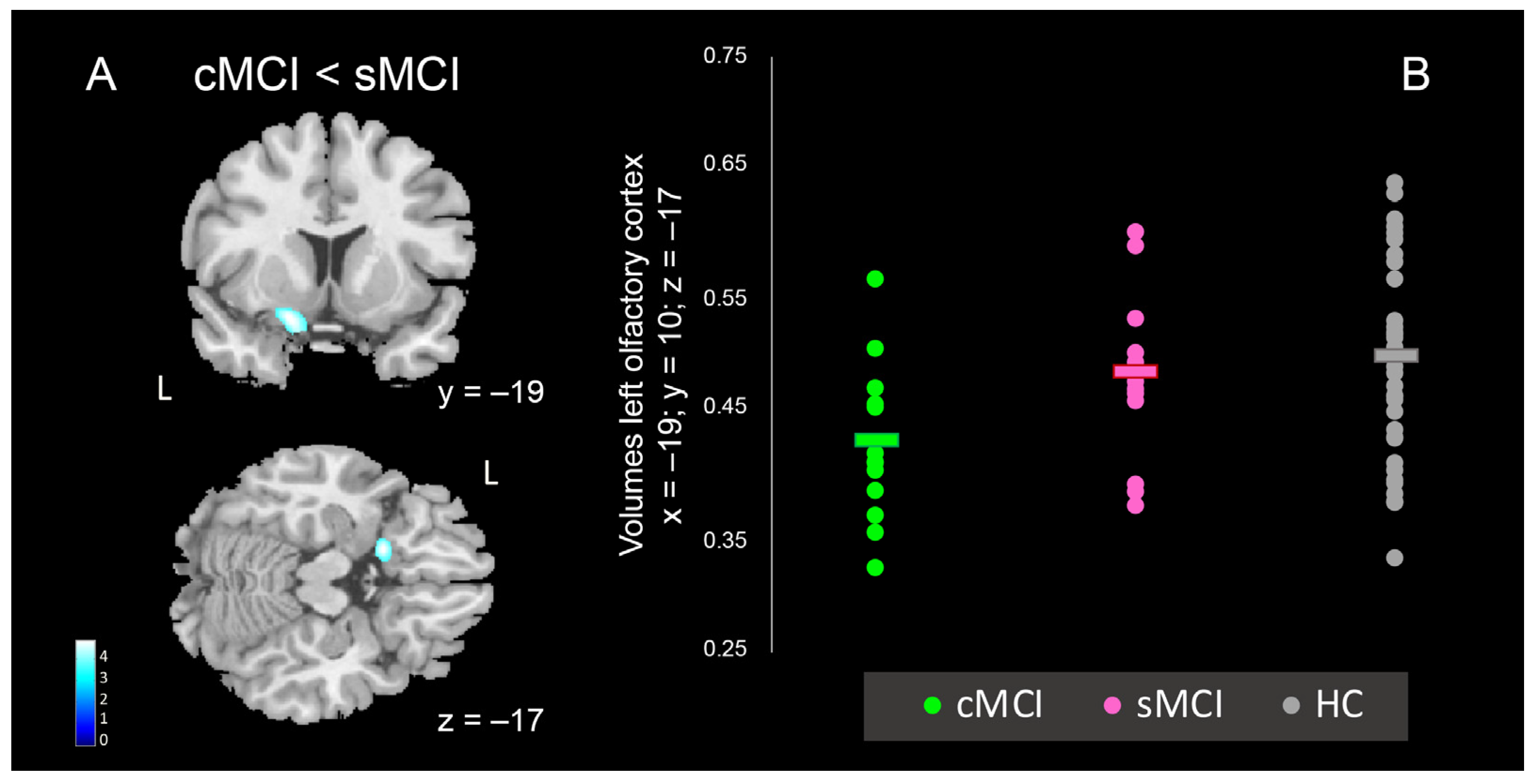 Brainsci 15 00310 g004