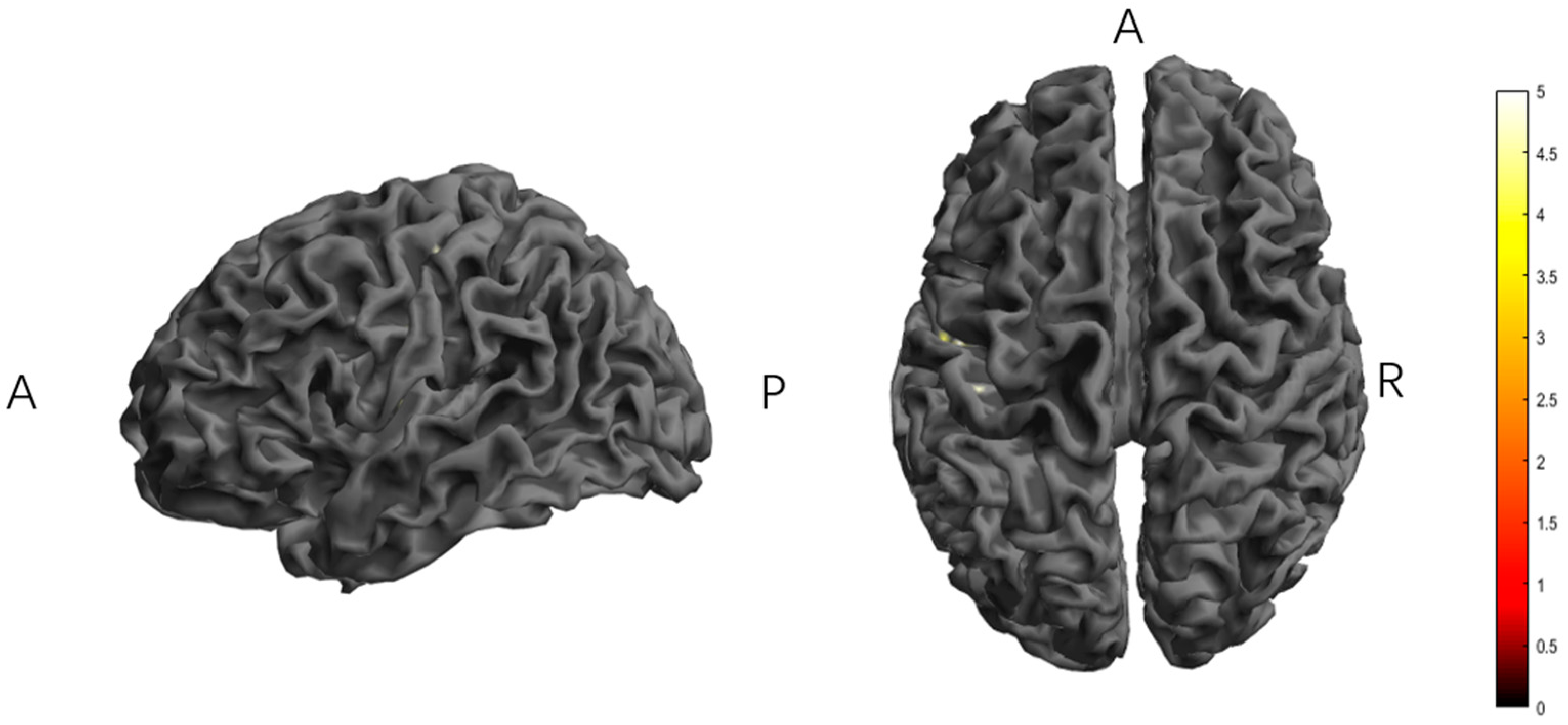 Brainsci 15 00317 g004