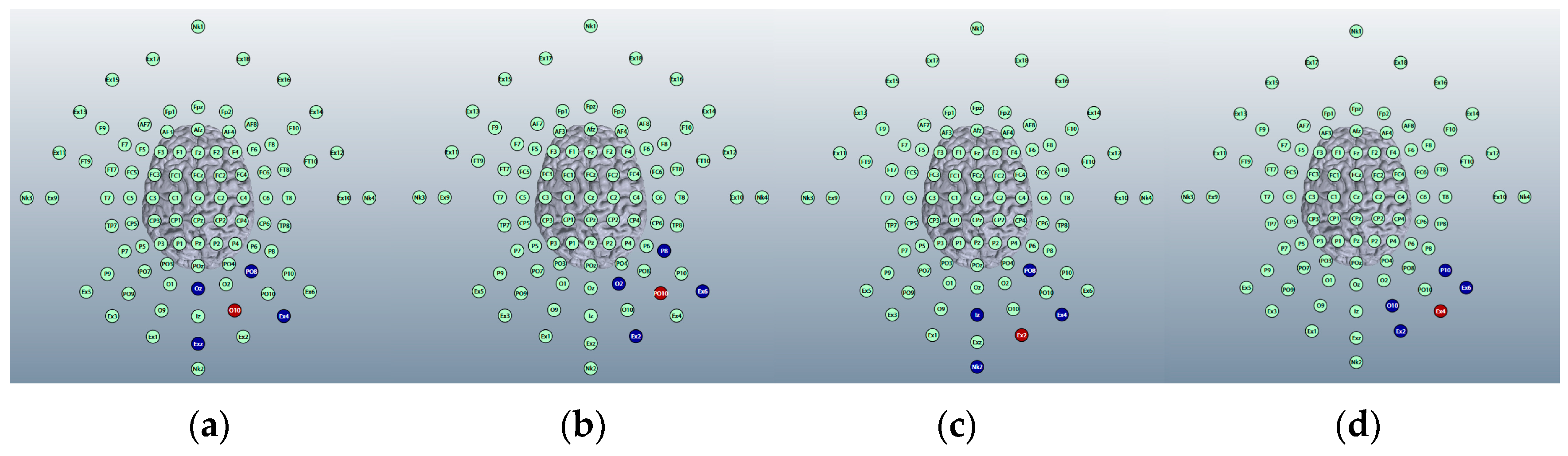 Brainsci 15 00344 g014