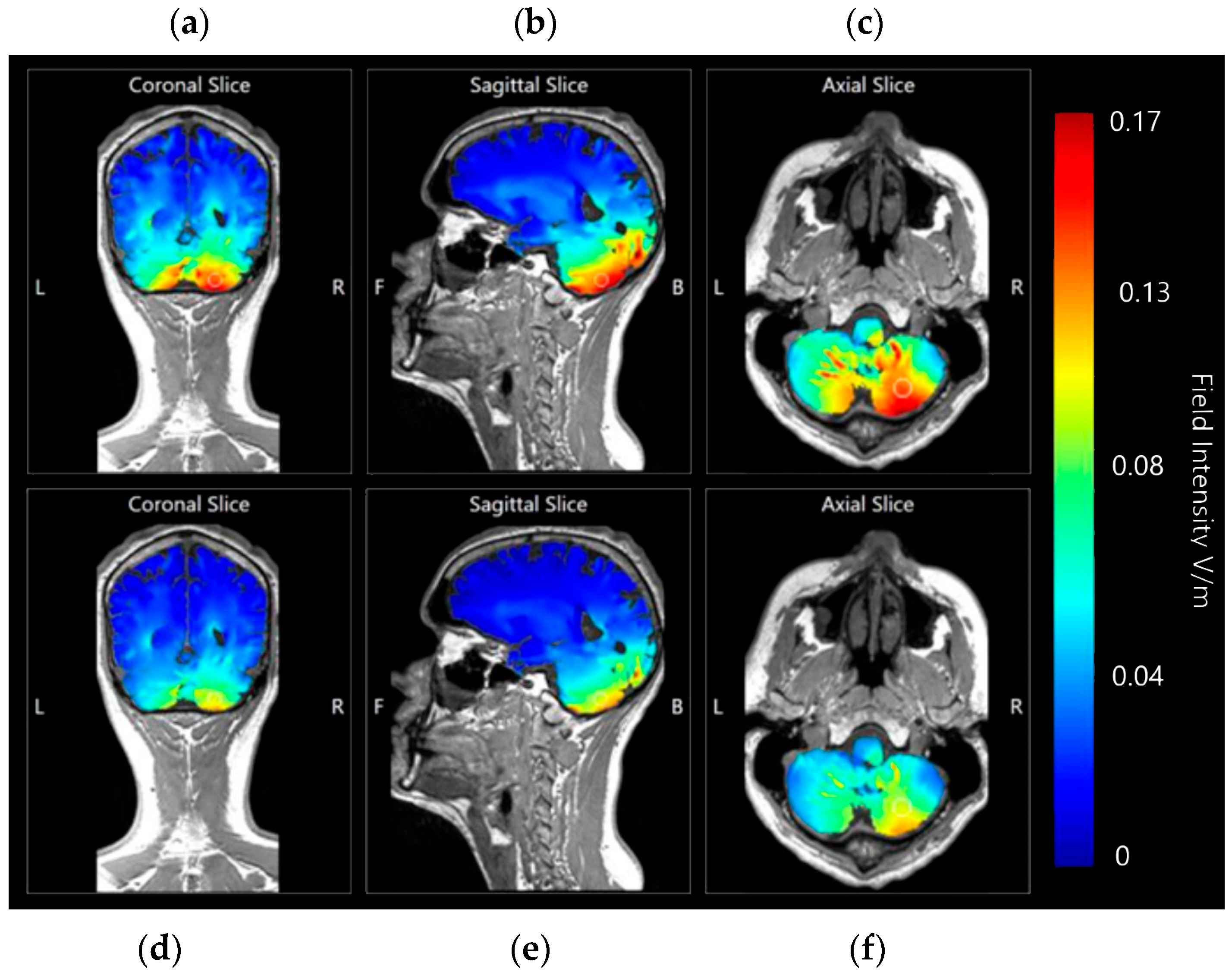 Brainsci 15 00344 g023