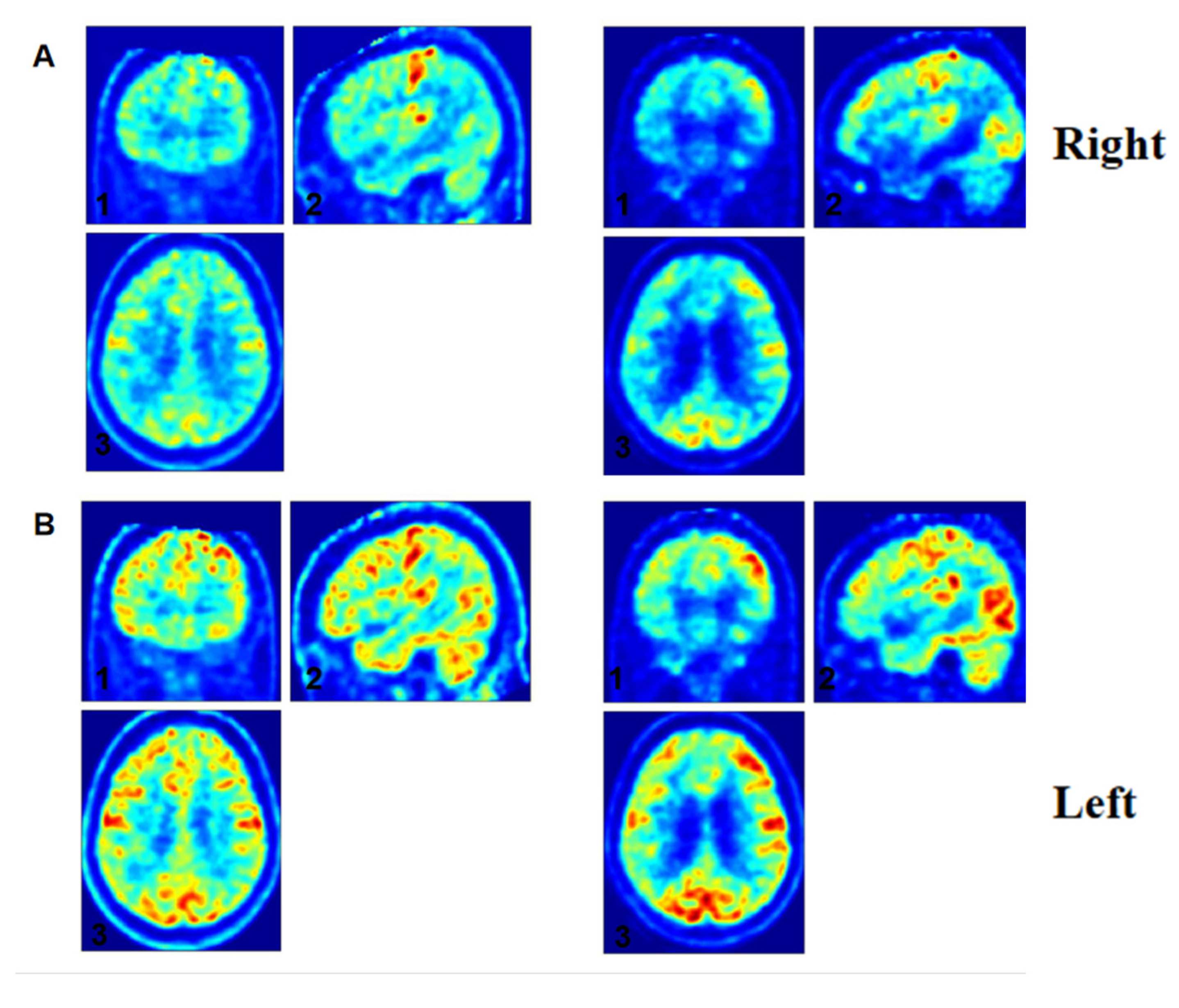Brainsci 15 00377 g006