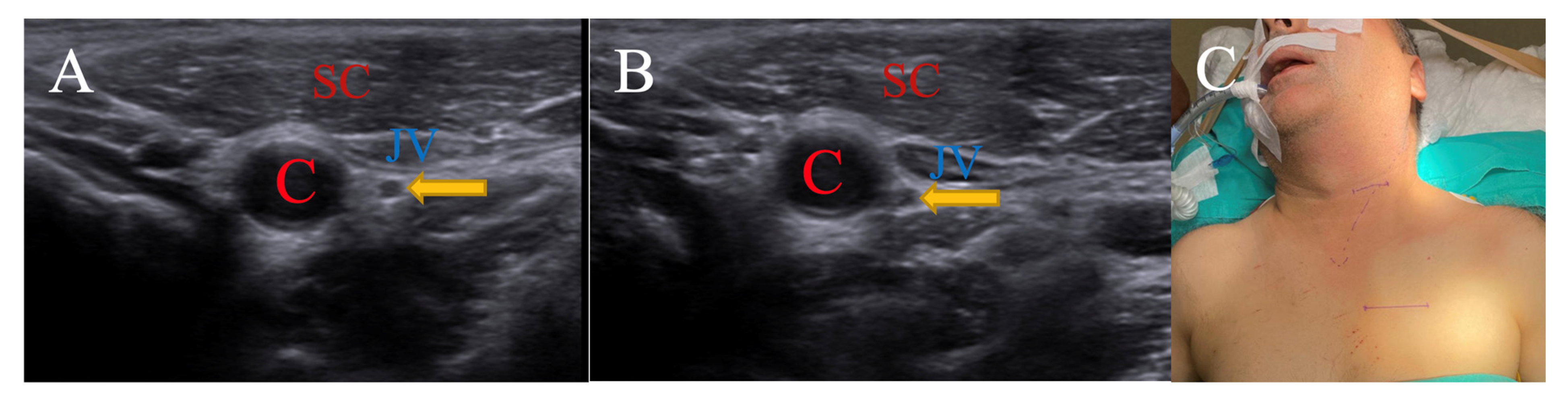 Brainsci 15 00385 g002 Brainsci 15 00385 g002