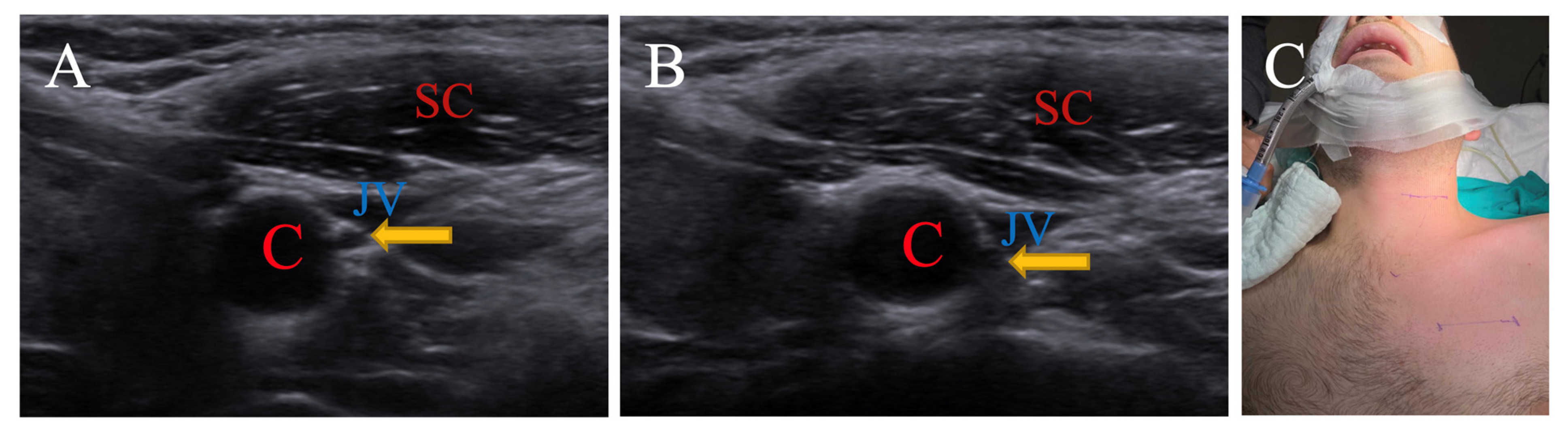 Brainsci 15 00385 g004 Brainsci 15 00385 g004