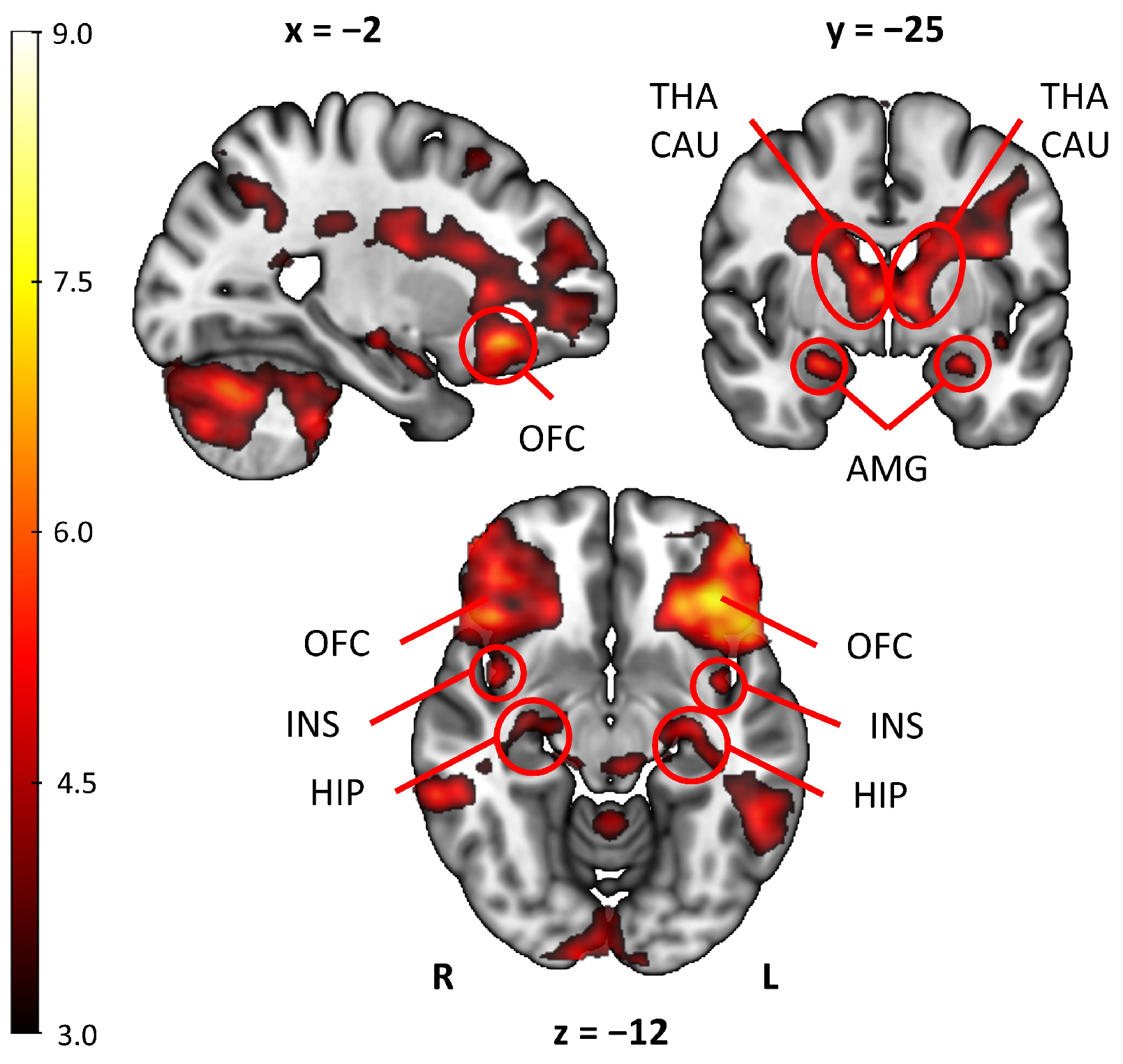 Brainsci 15 00418 g002 Brainsci 15 00418 g002