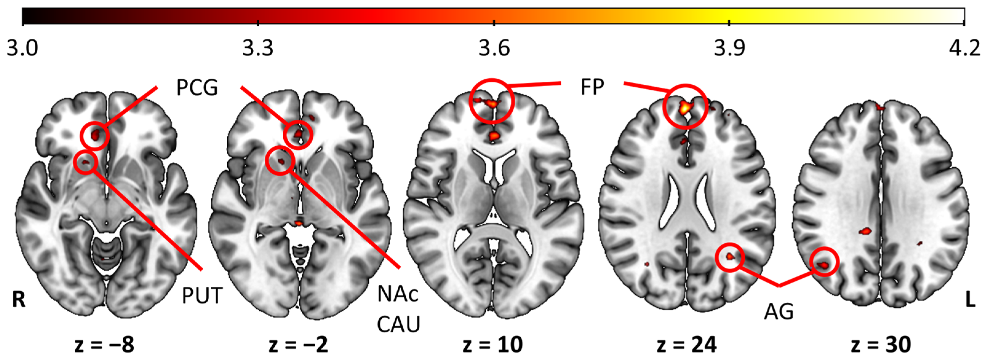 Brainsci 15 00418 g003 Brainsci 15 00418 g003