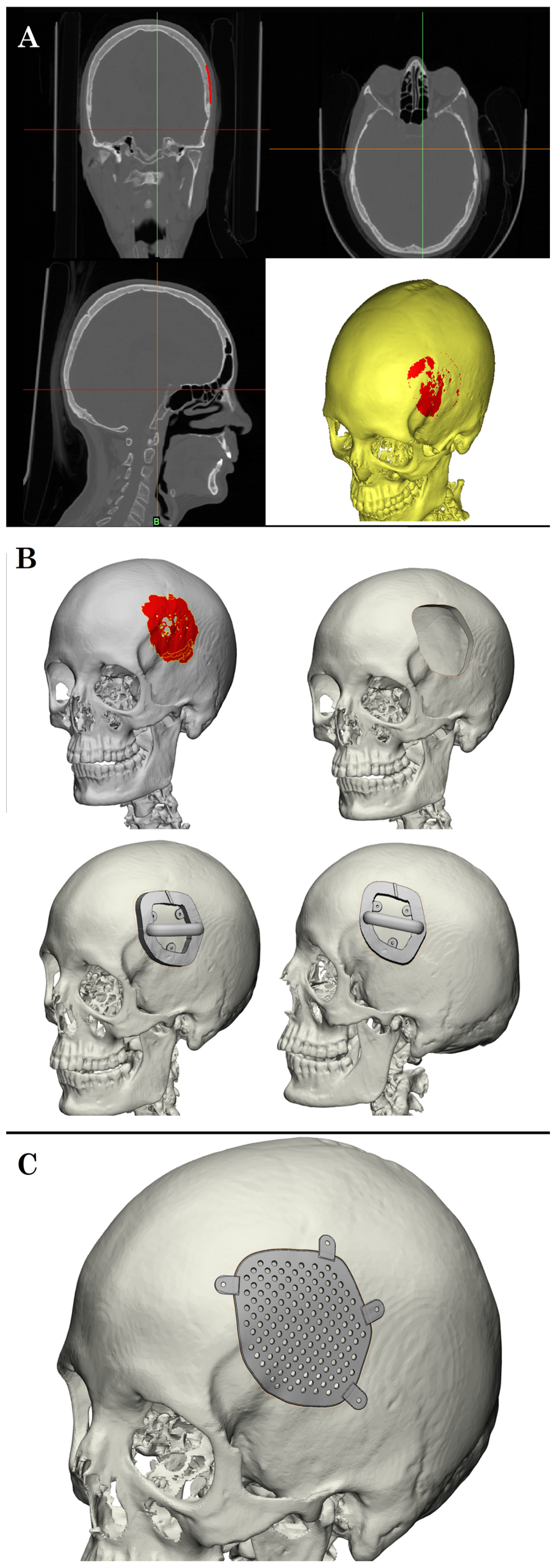Brainsci 15 00420 g002