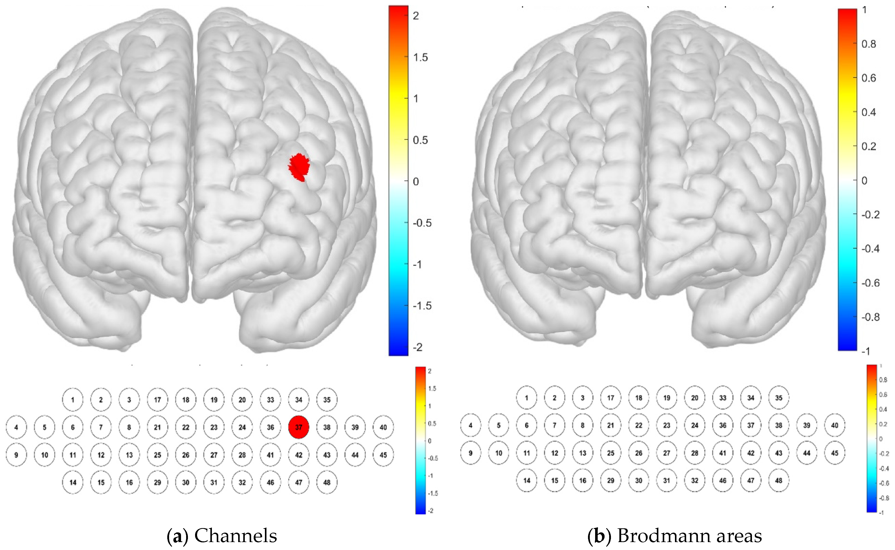 Brainsci 15 00439 g005