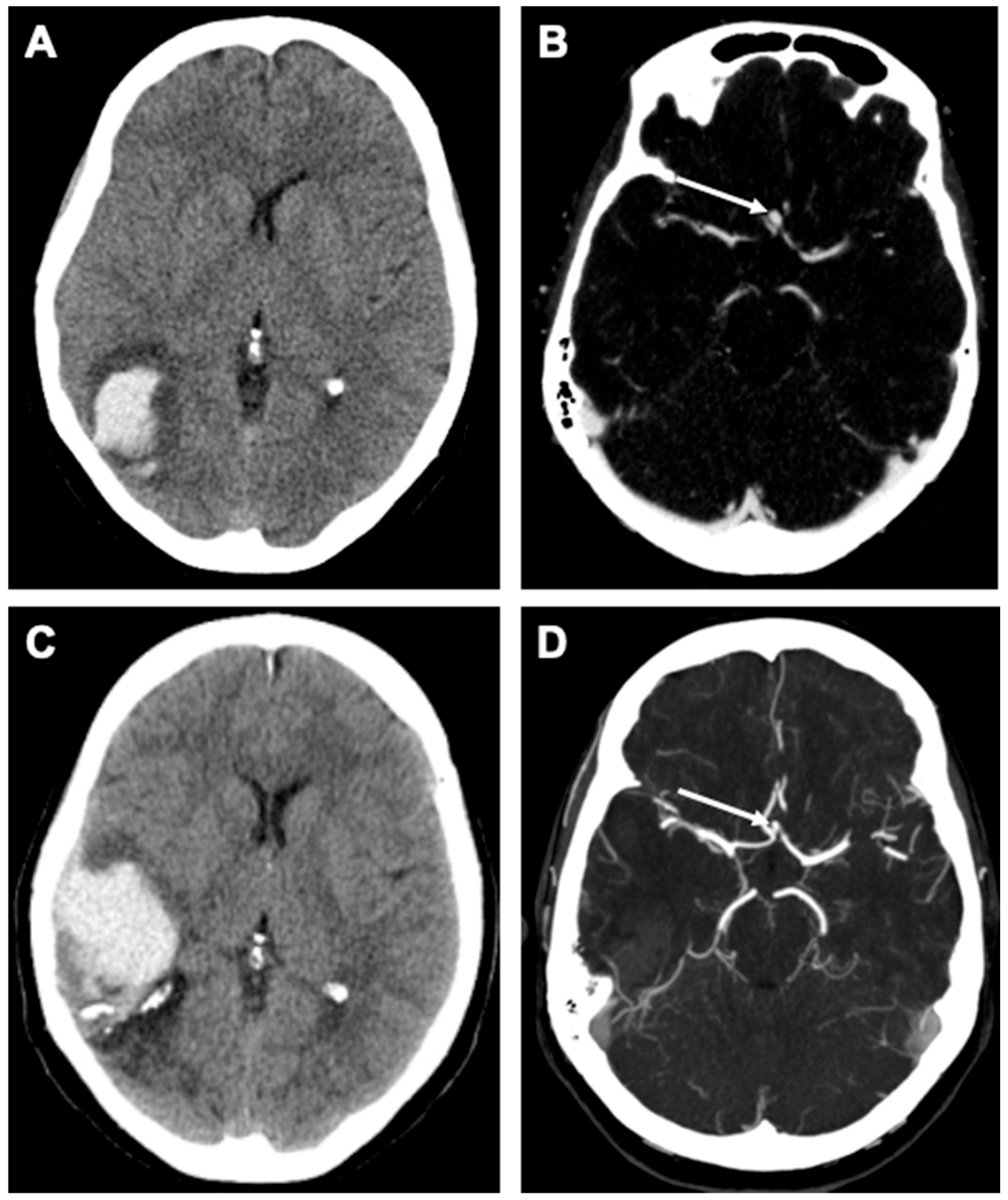 Brainsci 15 00488 g002