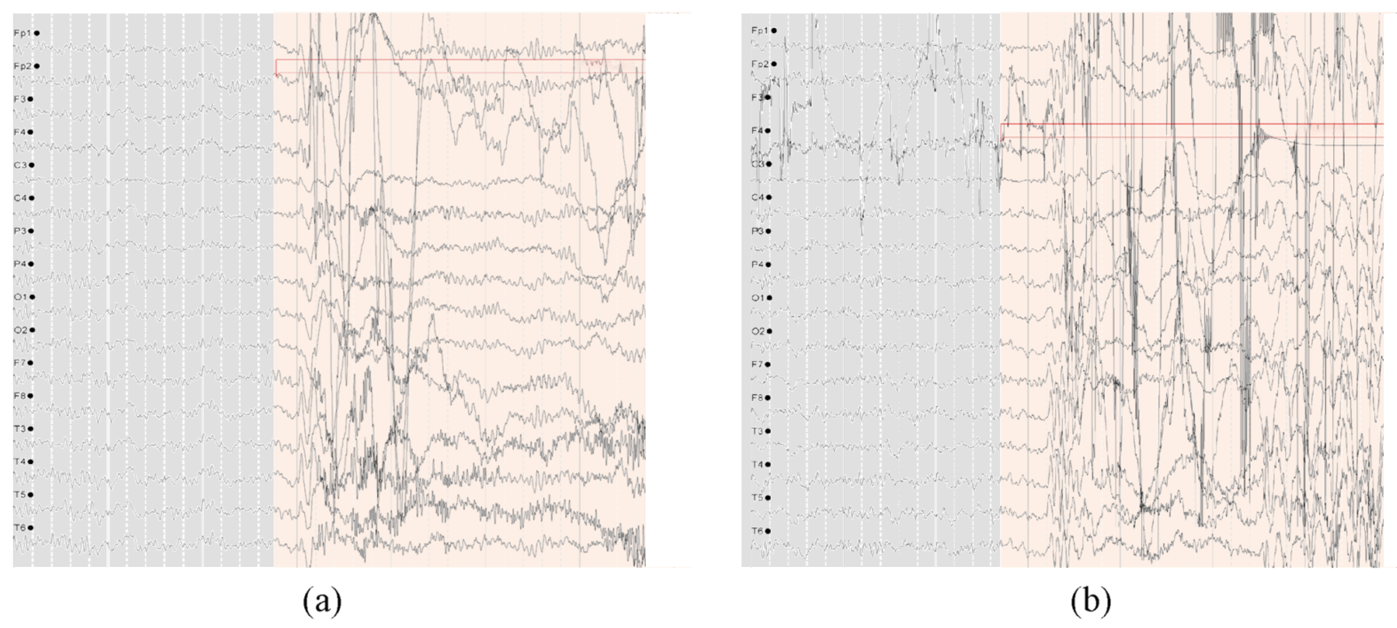 Brainsci 15 00509 g009