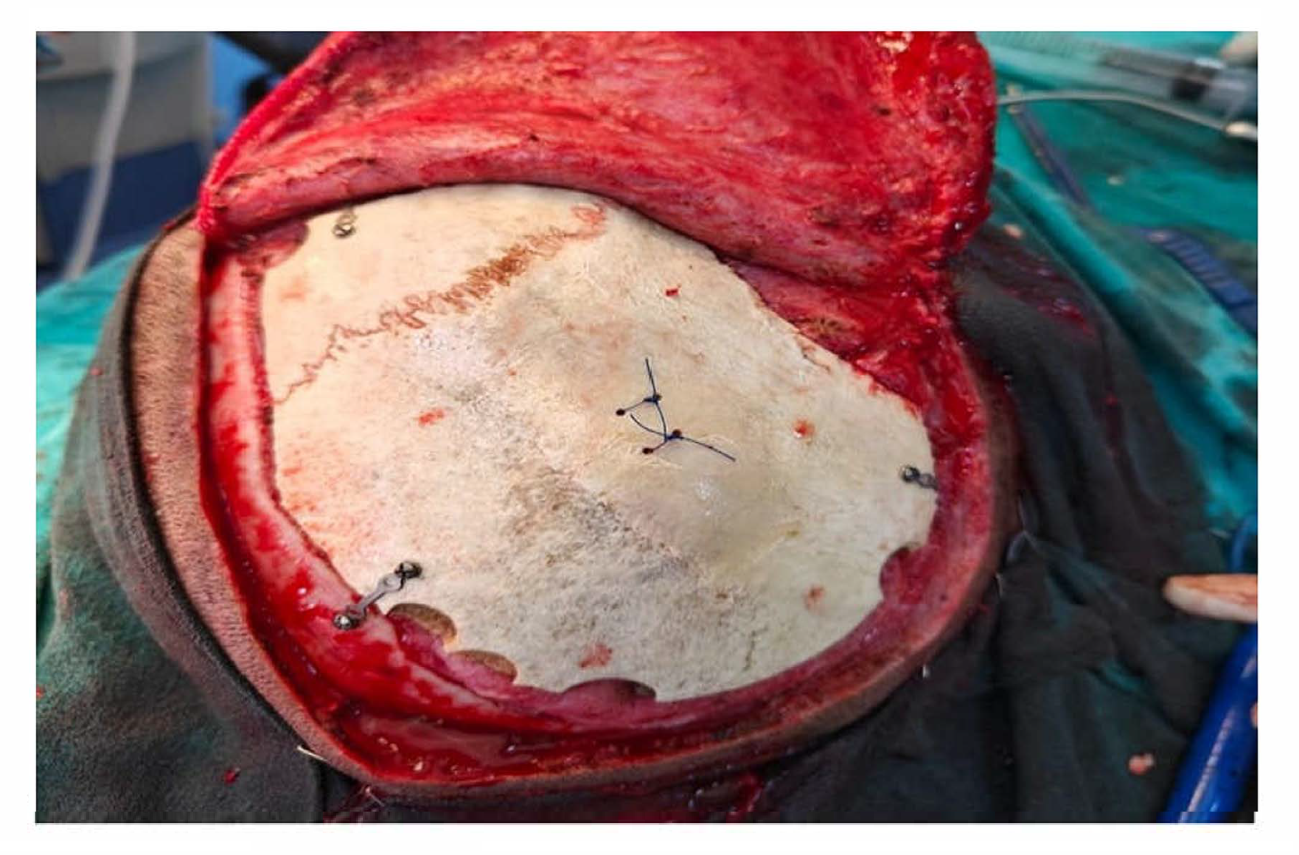 Brainsci 15 00514 g001