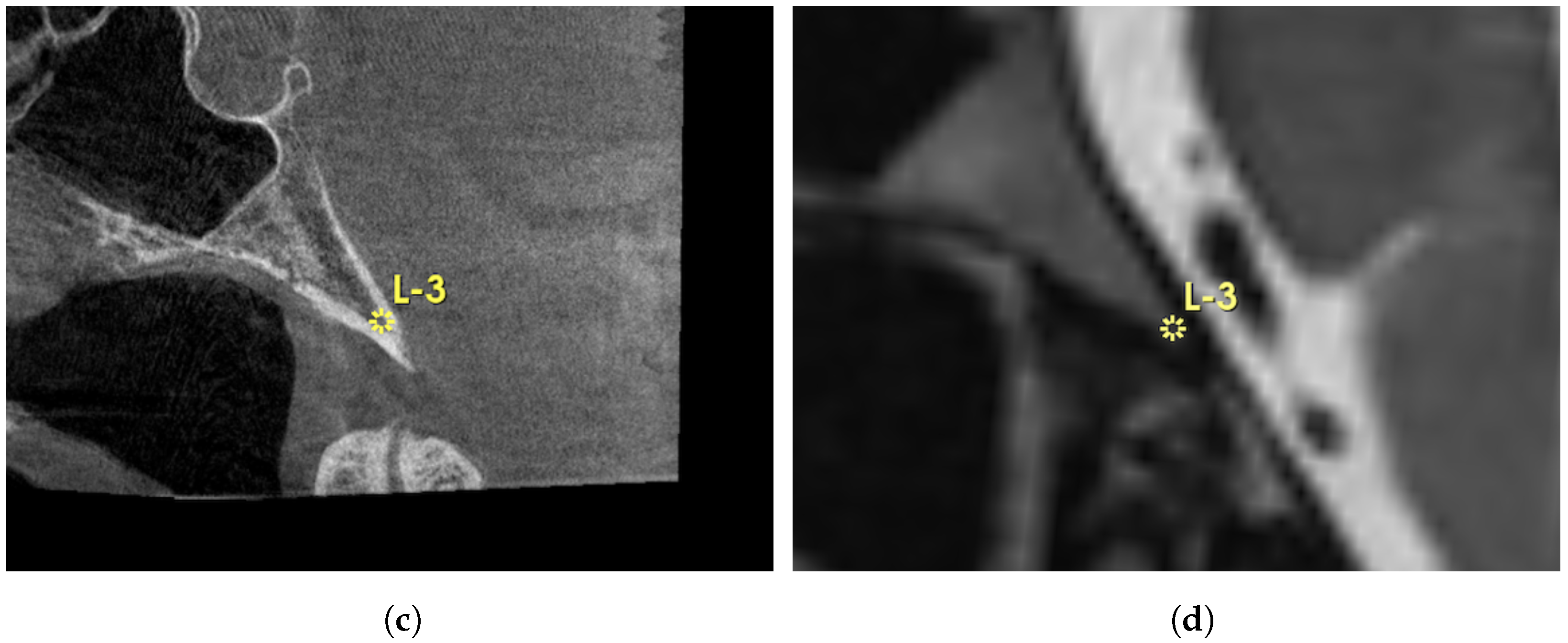 Brainsci 15 00521 g001b