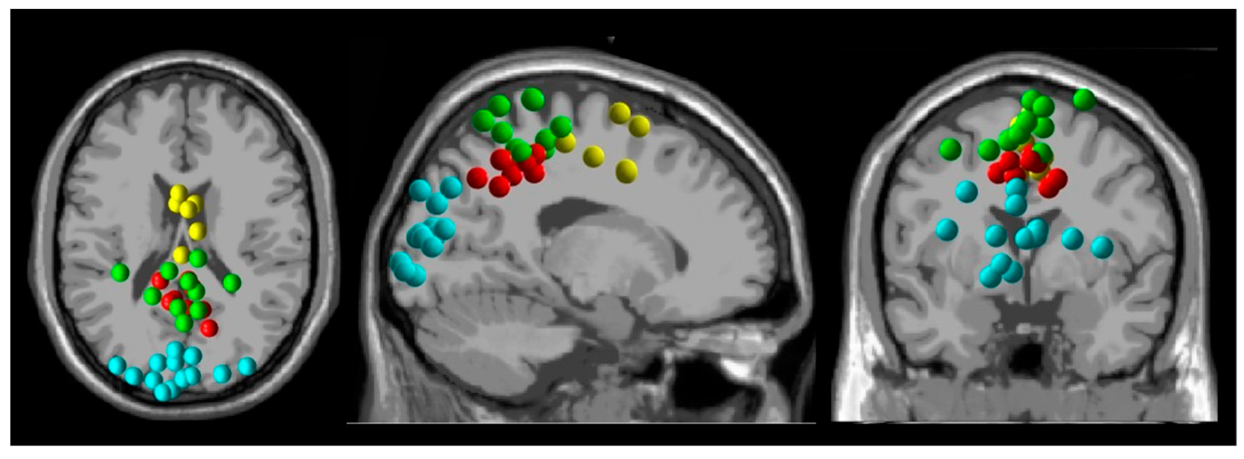 Brainsci 15 00531 g002
