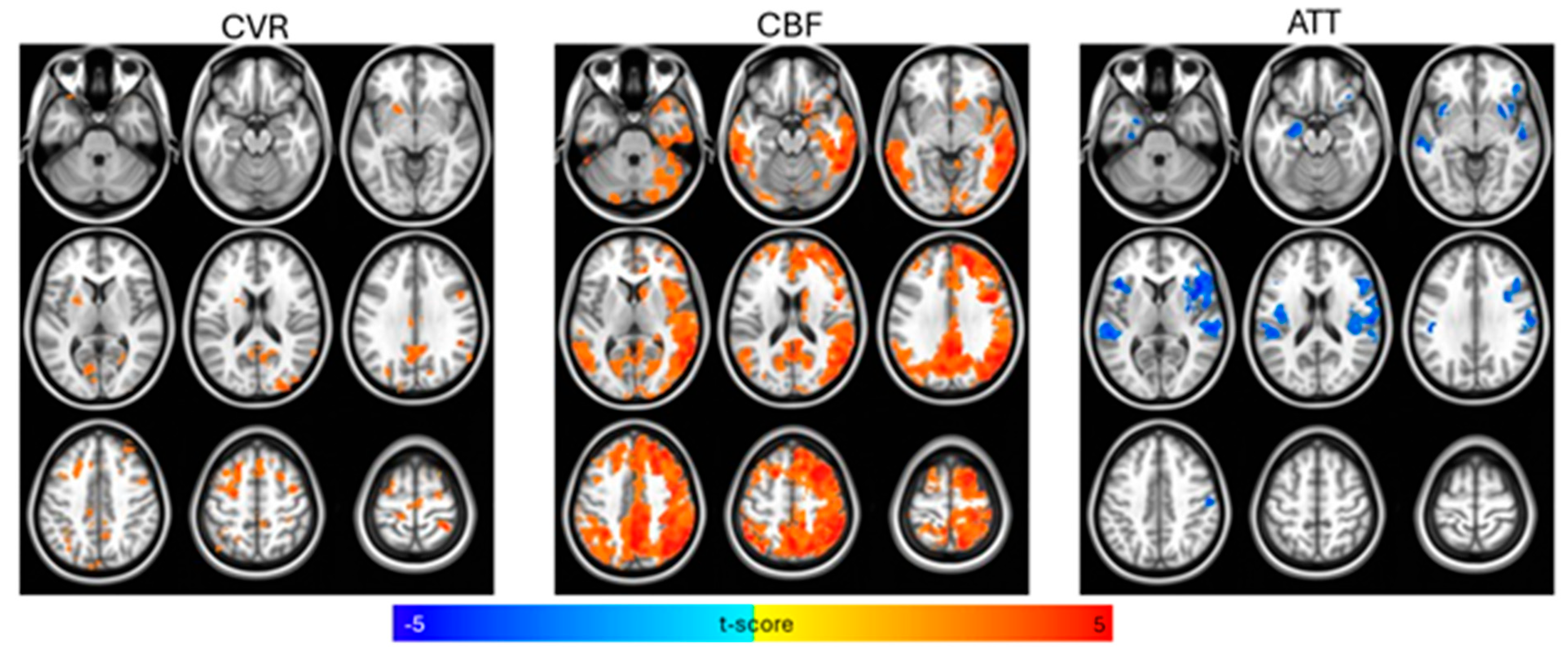 Brainsci 15 00538 g001