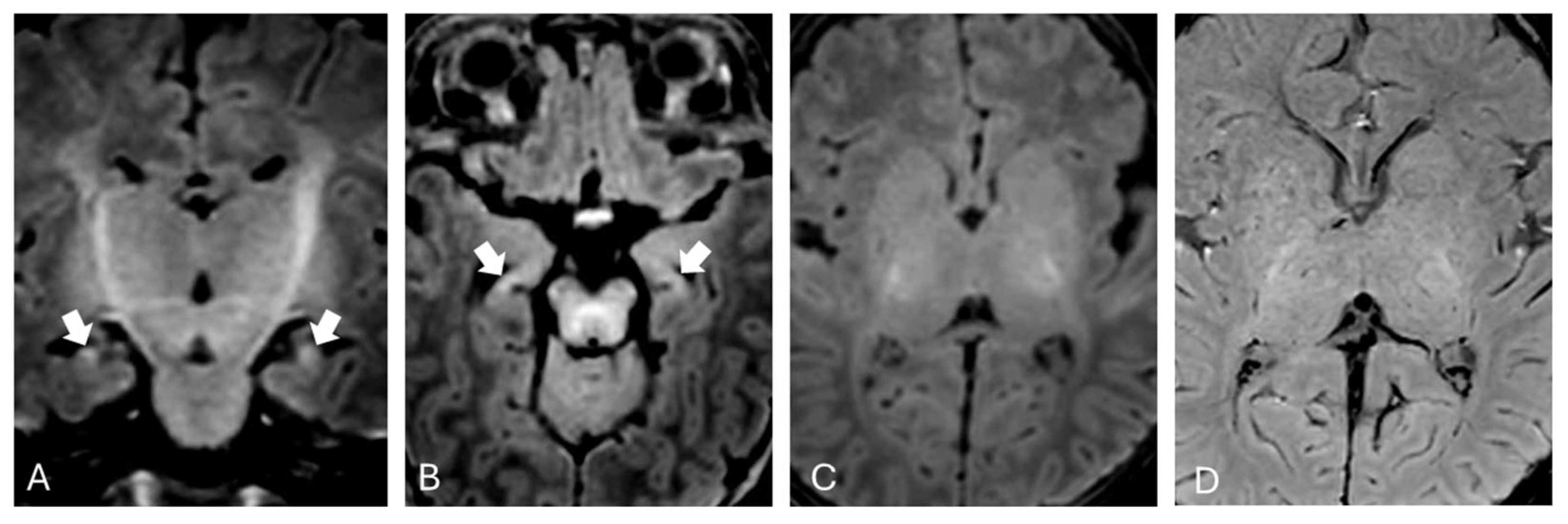 Brainsci 15 00539 g001