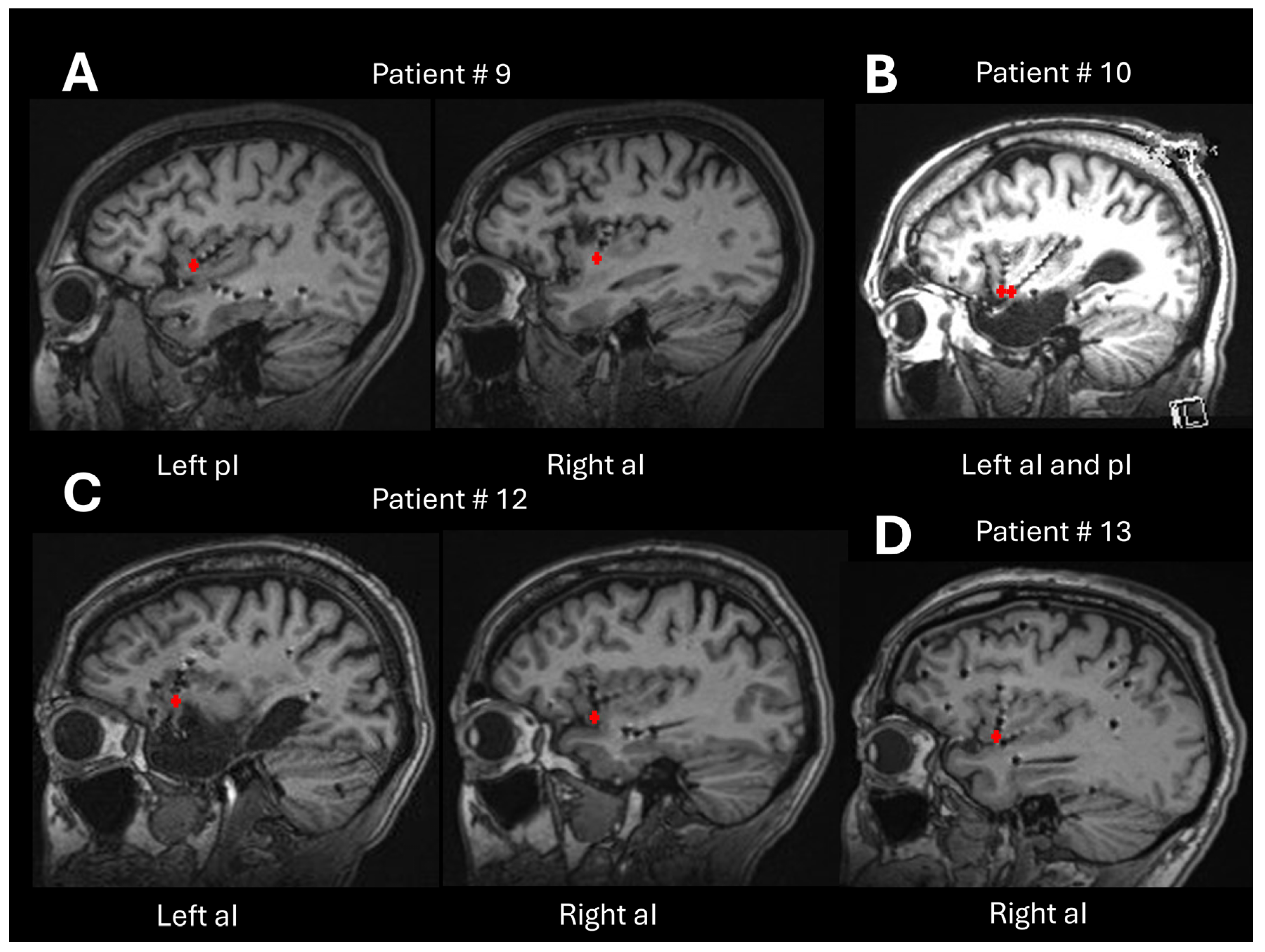 Brainsci 15 00550 g008