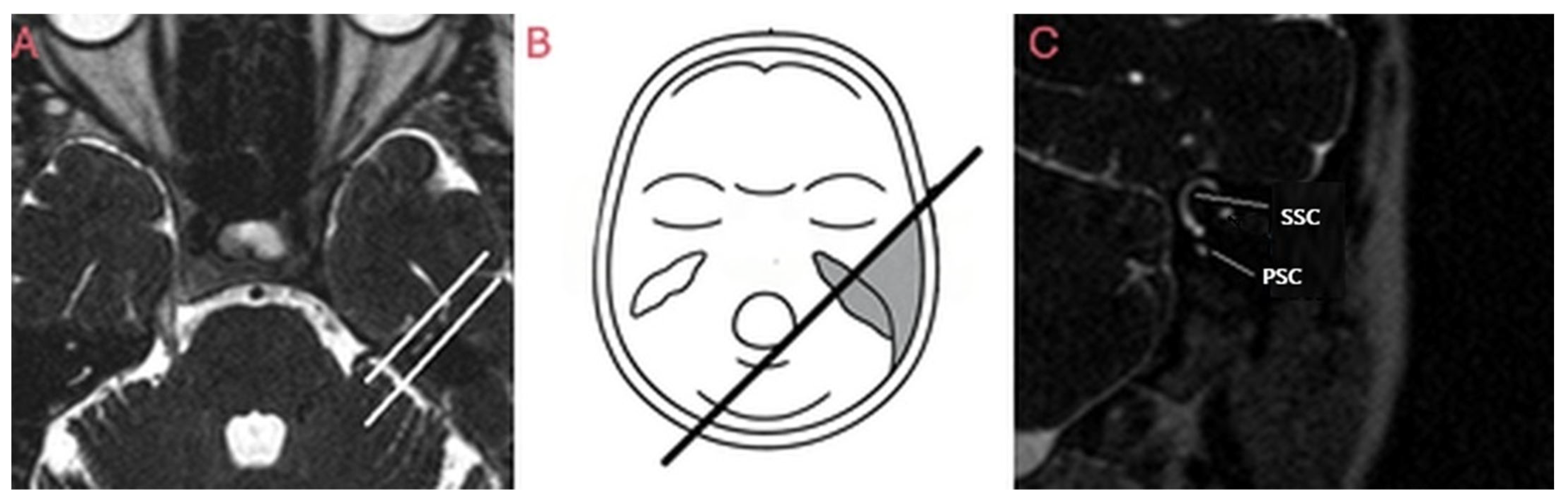 Brainsci 15 00555 g001