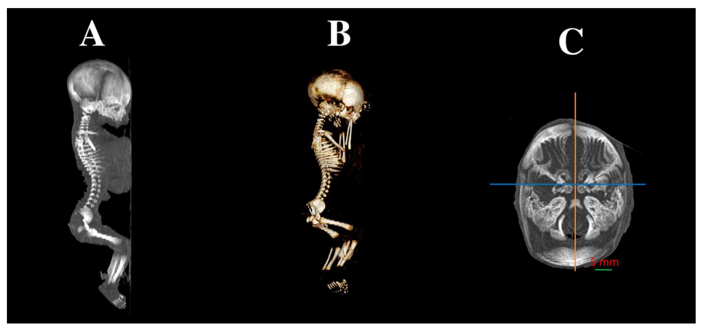 Brainsci 15 00558 g001