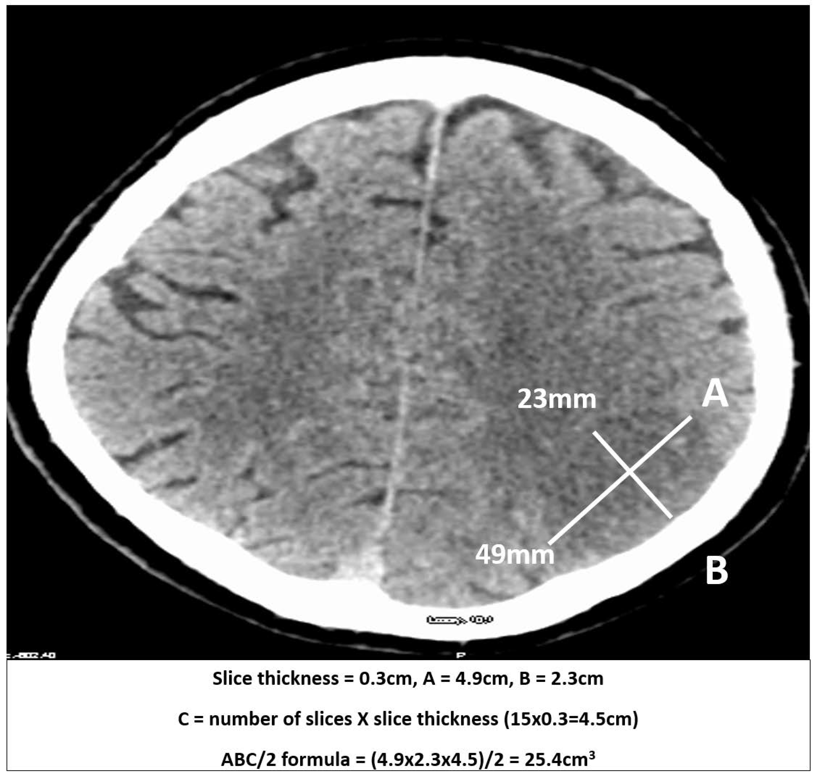 Brainsci 15 00560 g001