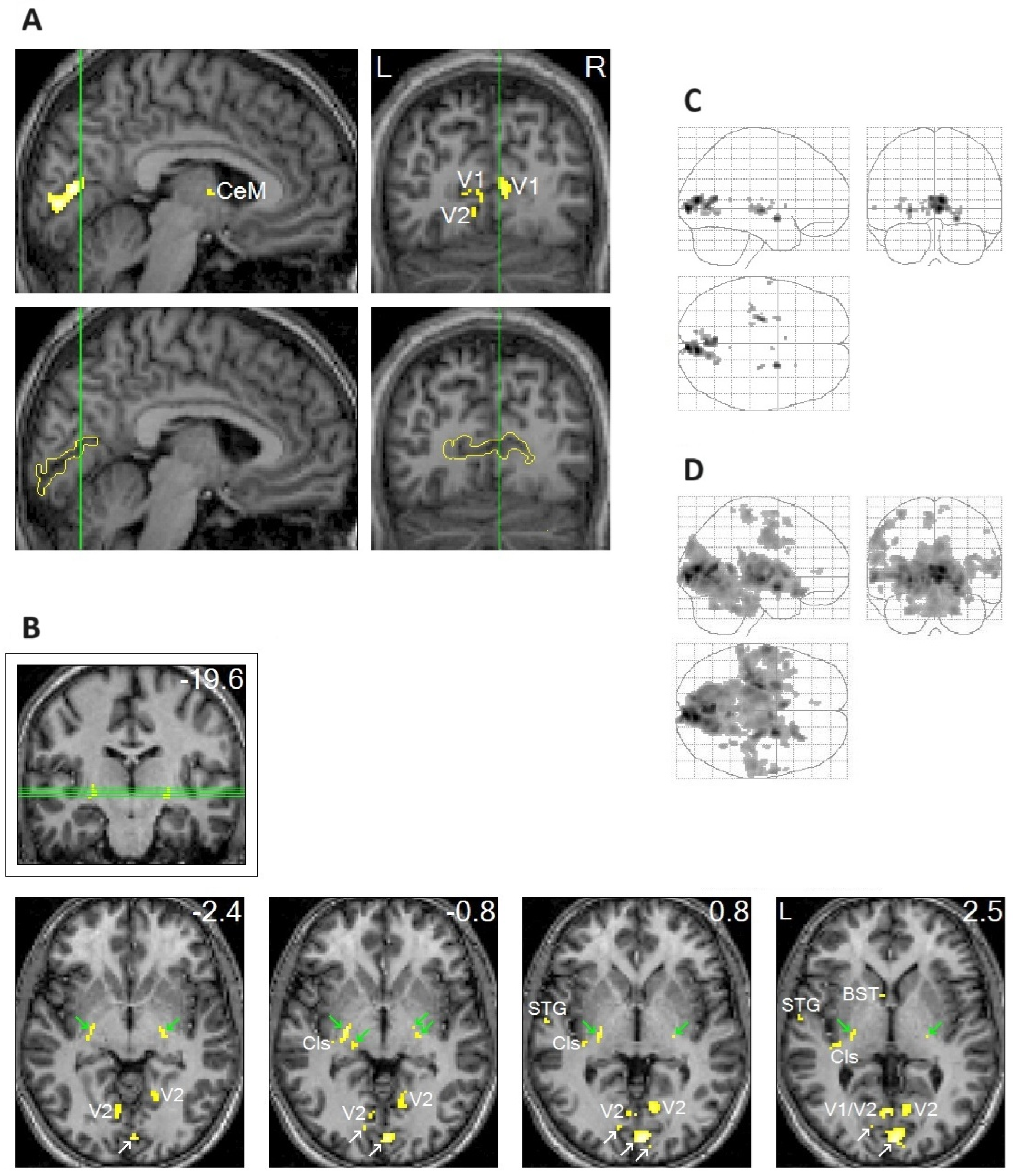 Brainsci 15 00574 g001