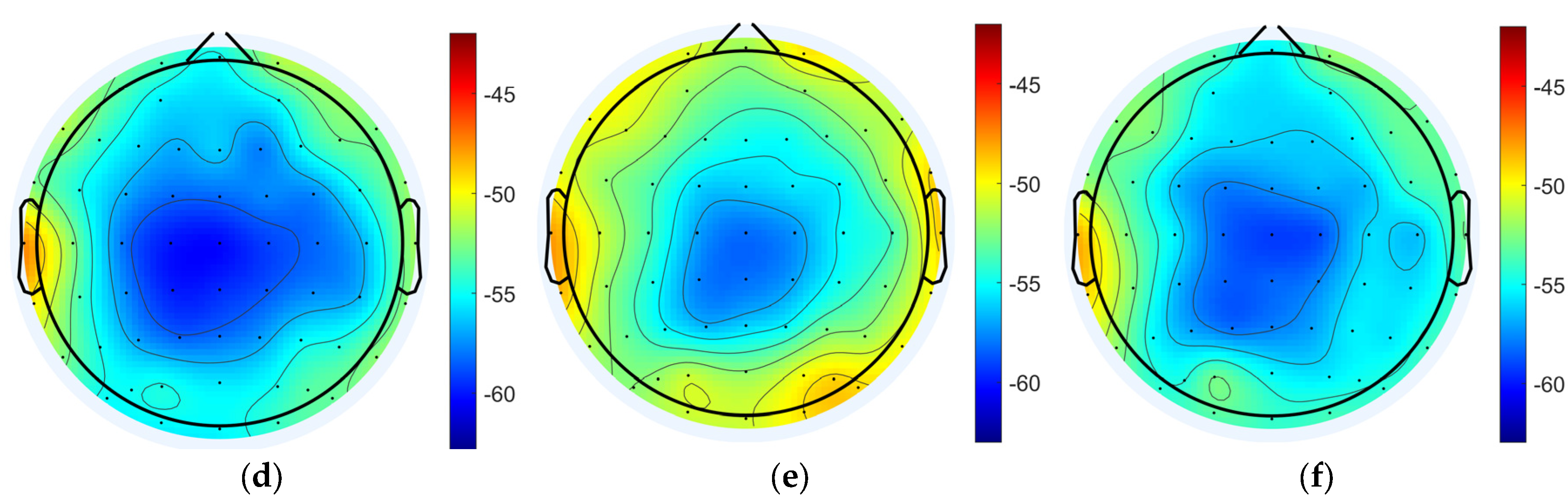 Brainsci 15 00579 g004b
