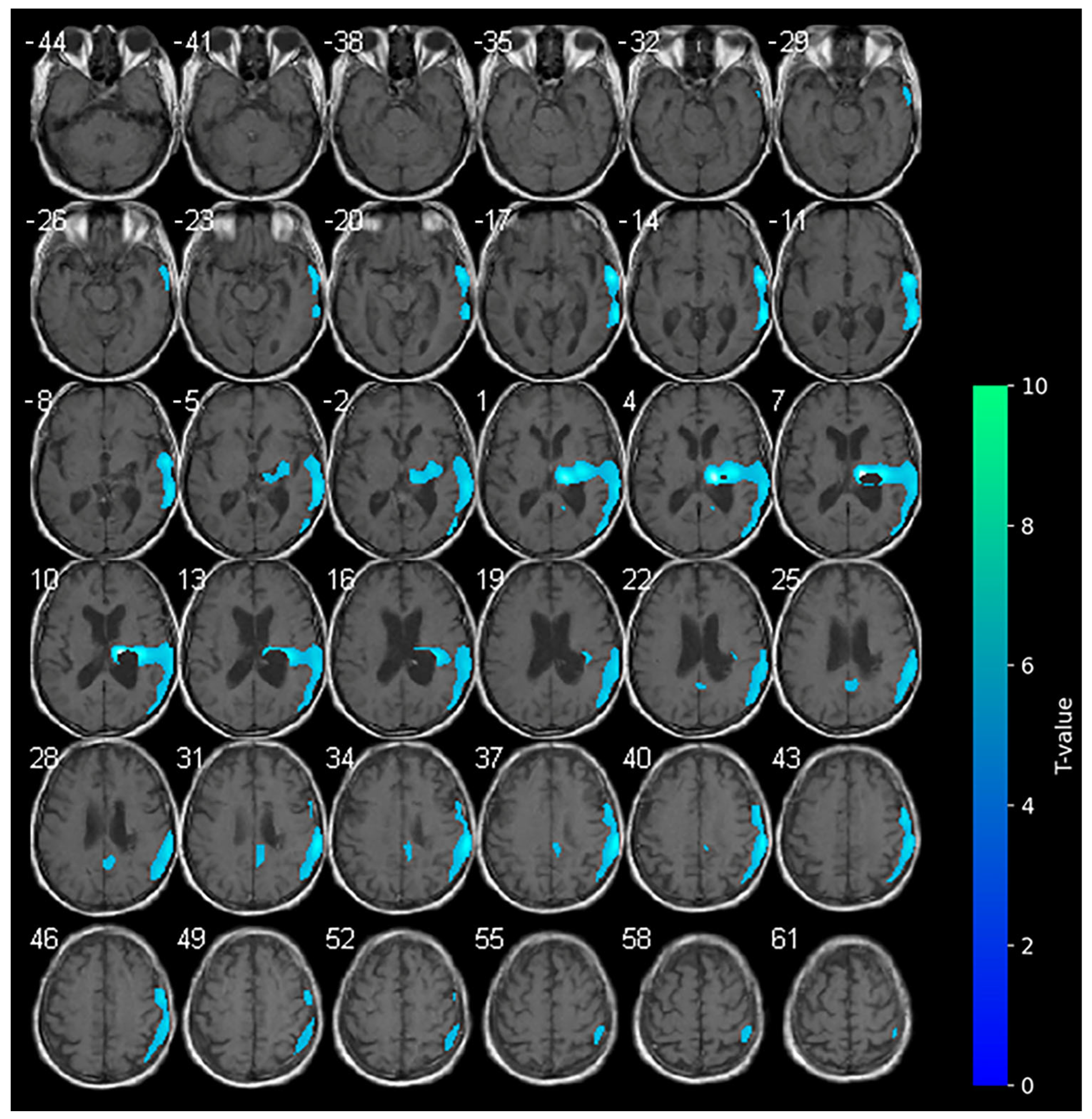 Brainsci 15 00594 g001