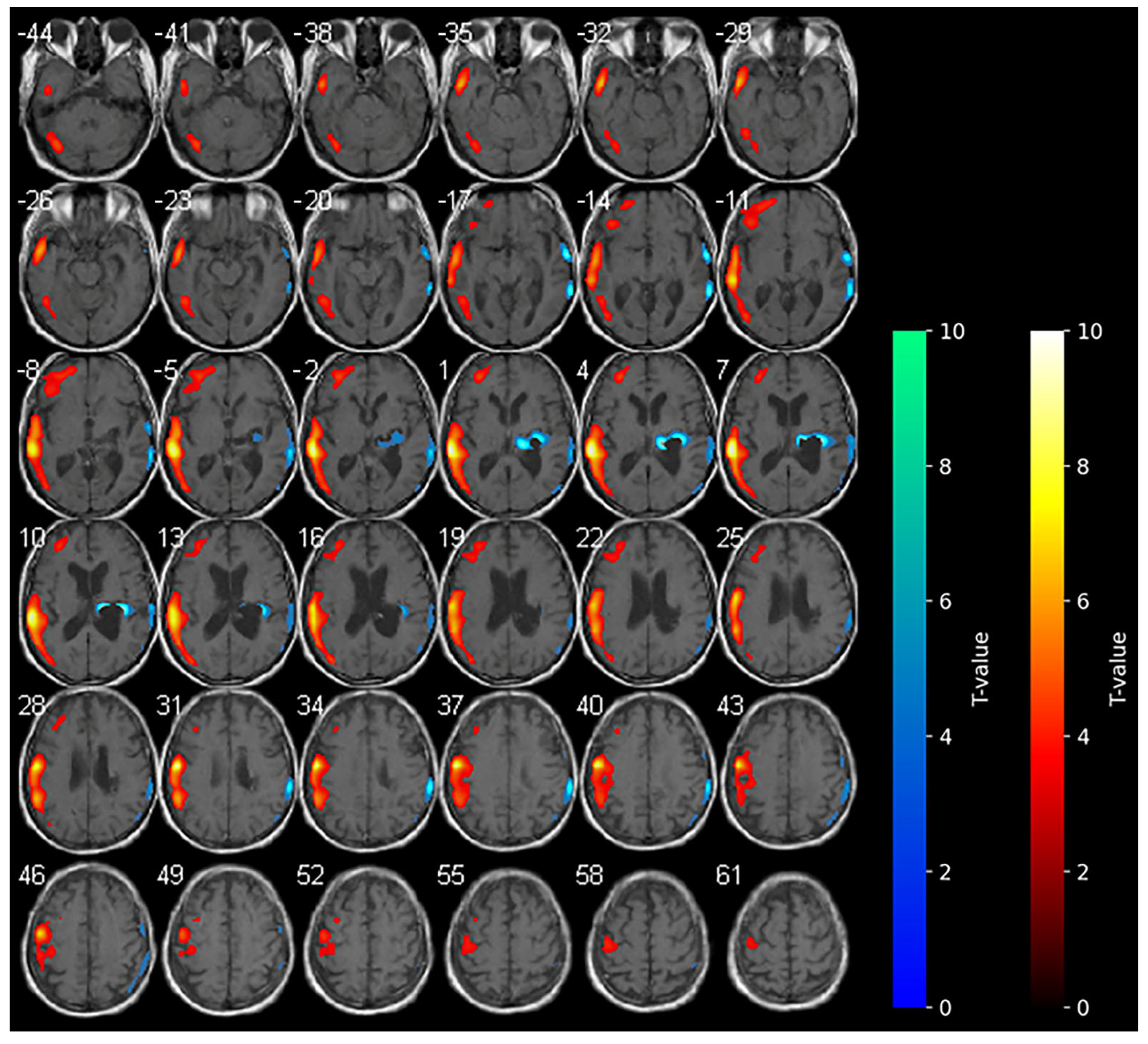 Brainsci 15 00594 g002