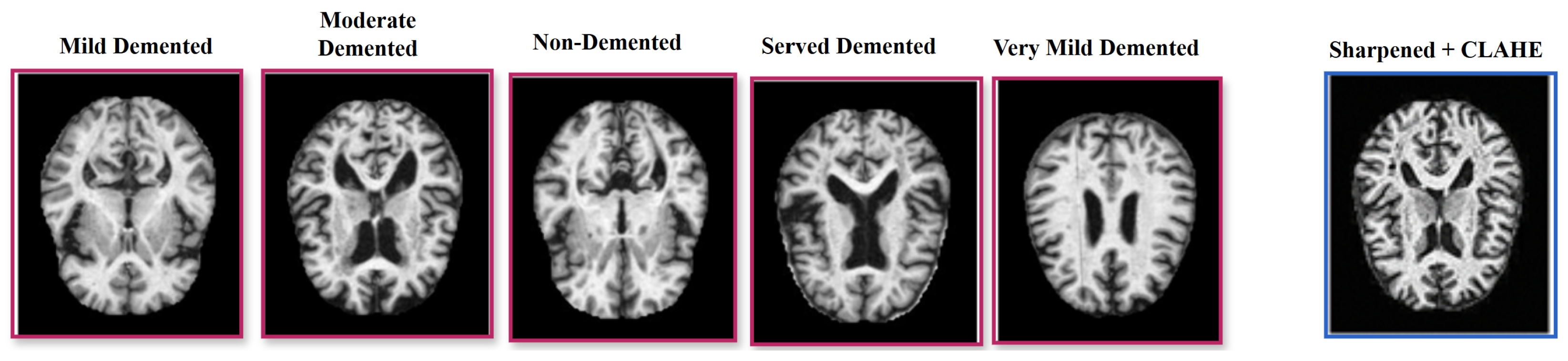Brainsci 15 00612 g001