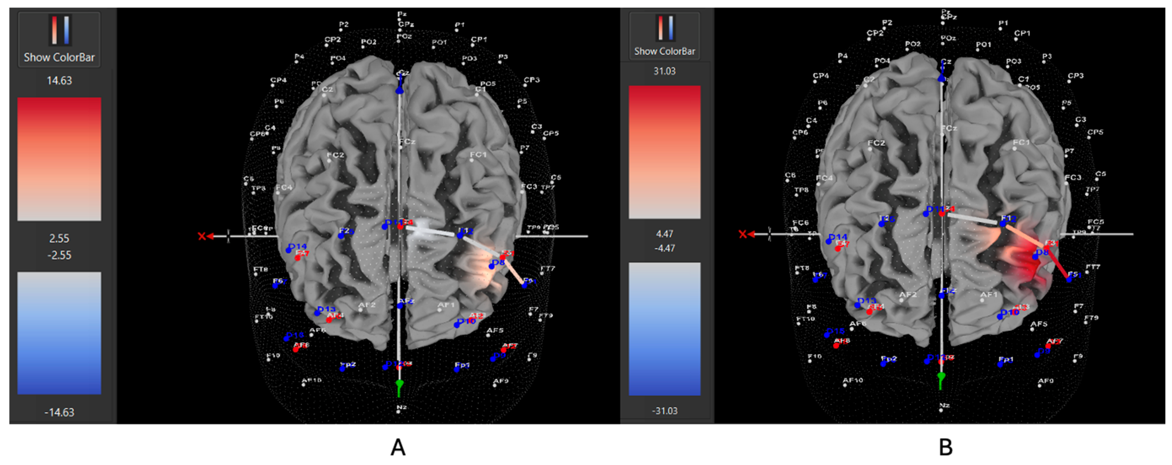 Brainsci 15 00623 g007