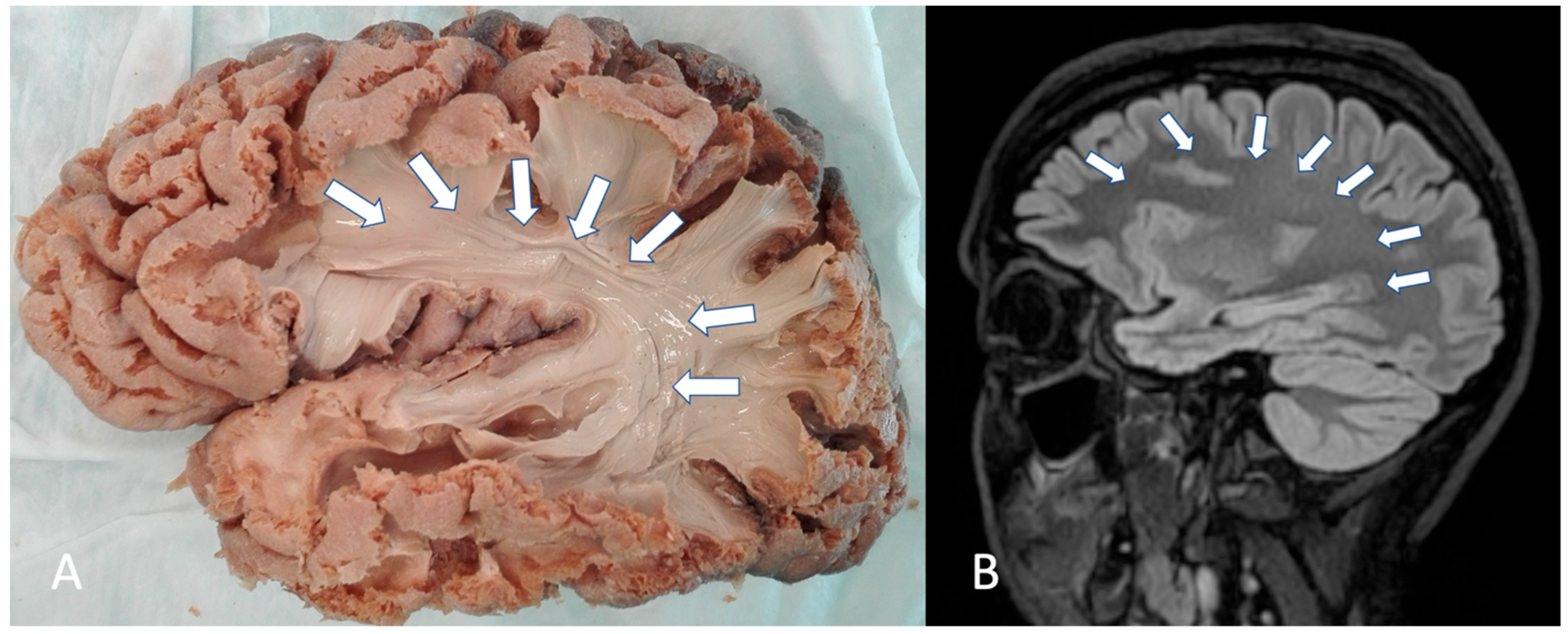 Brainsci 15 00625 g001