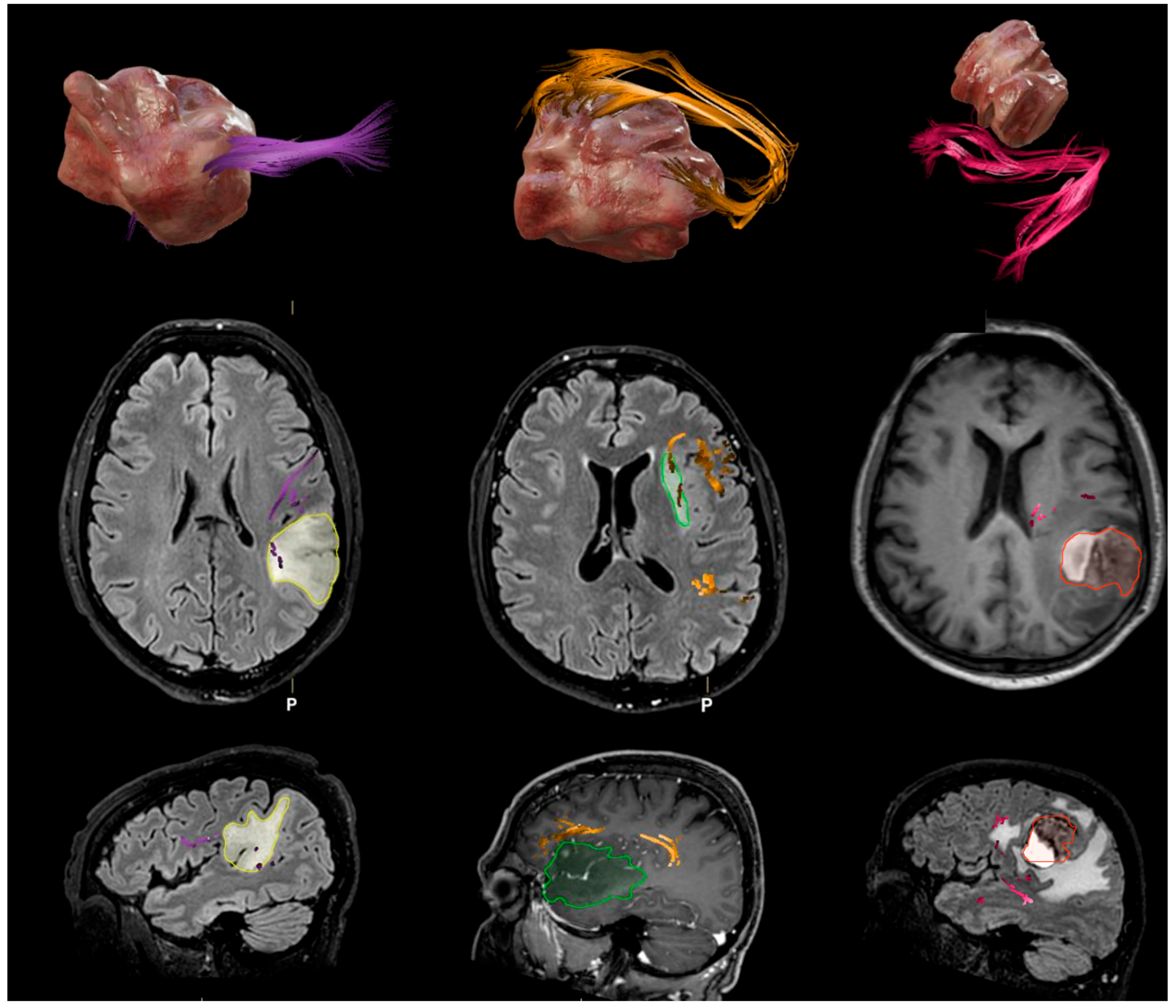 Brainsci 15 00625 g003