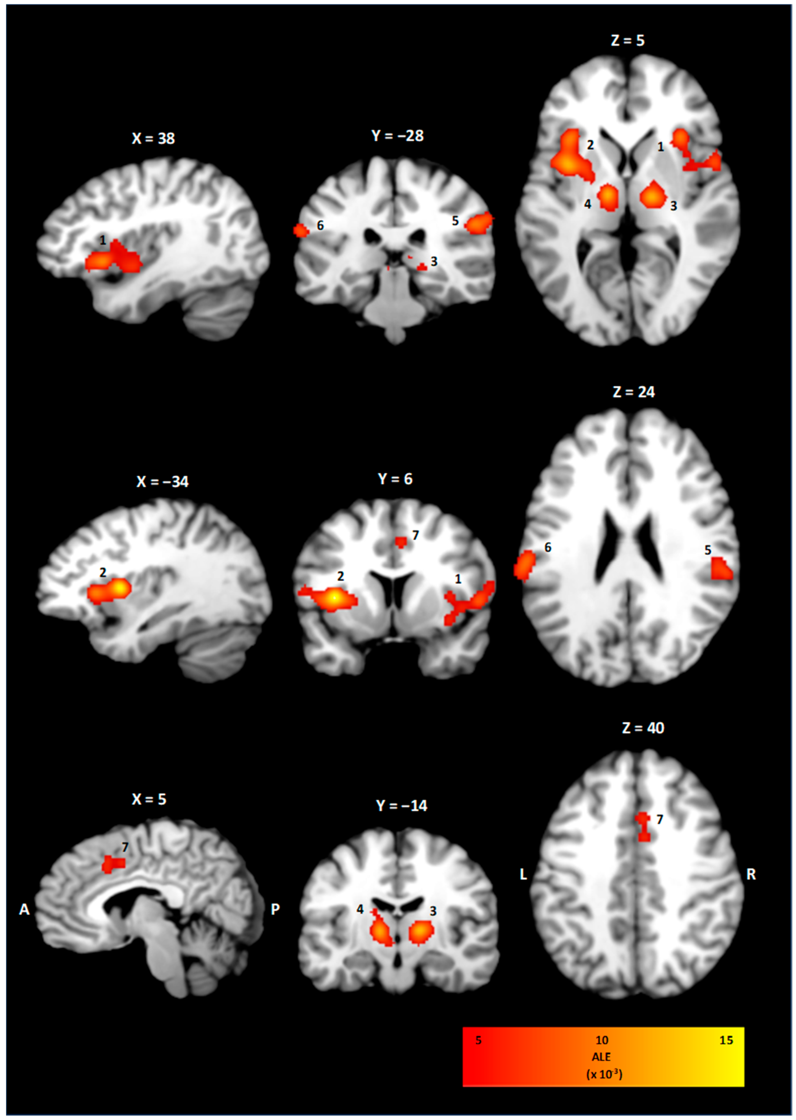 Brainsci 15 00651 g002