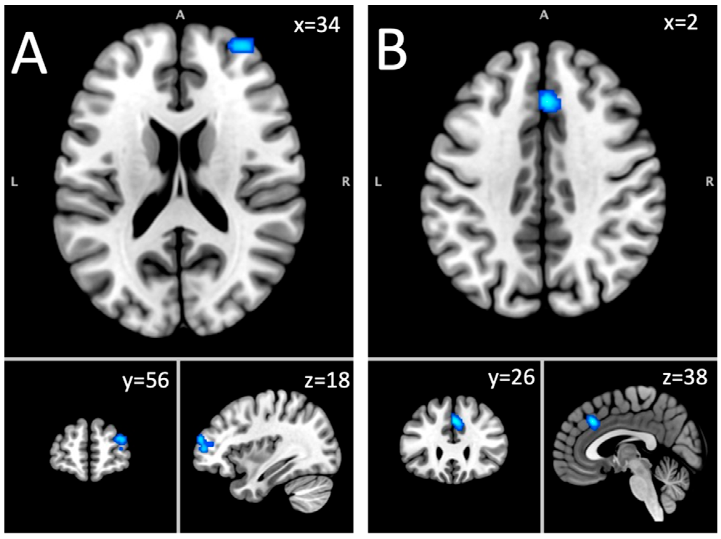 Brainsci 15 00665 g002