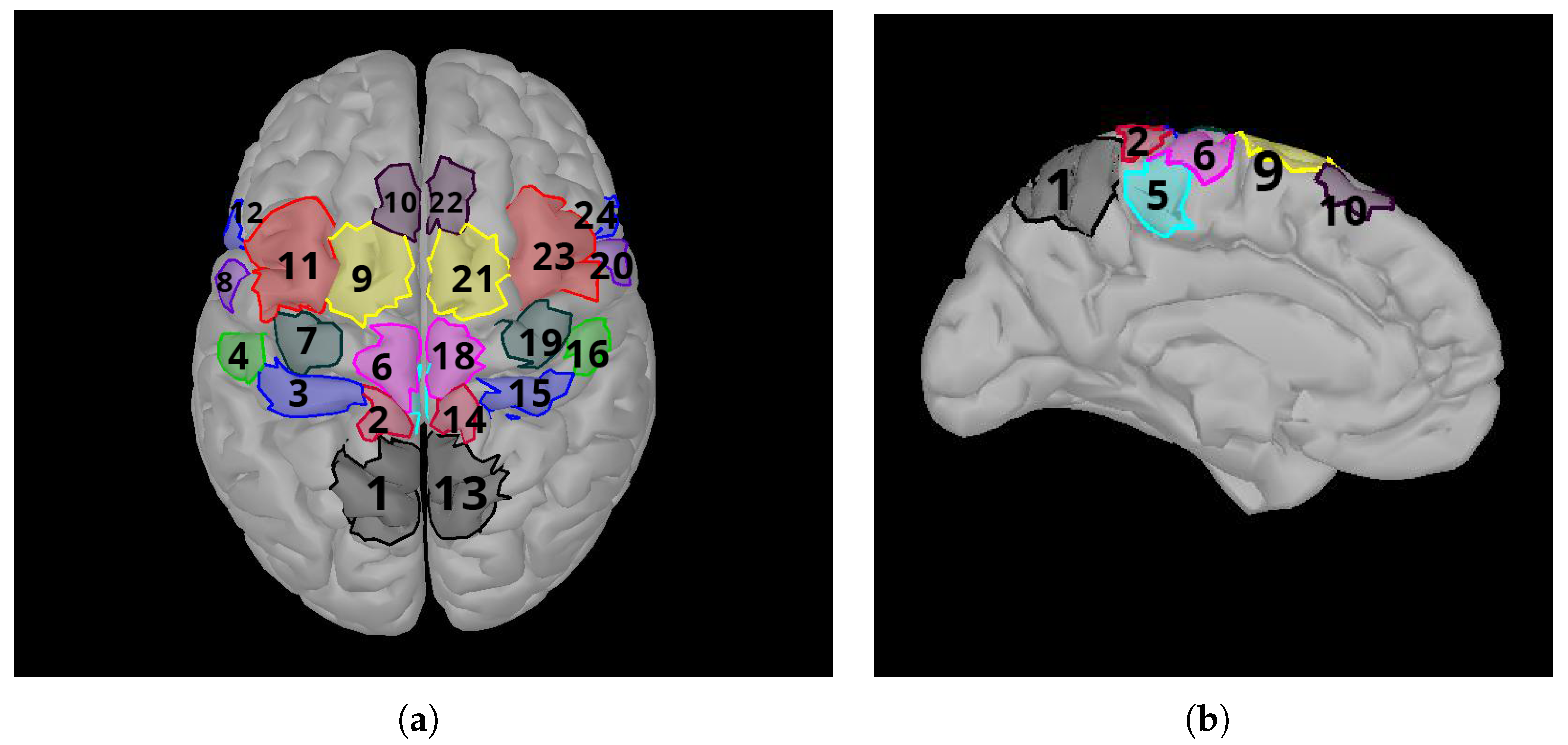 Effect of EEG Electrode Numbers on Source Estimation in Motor Imagery