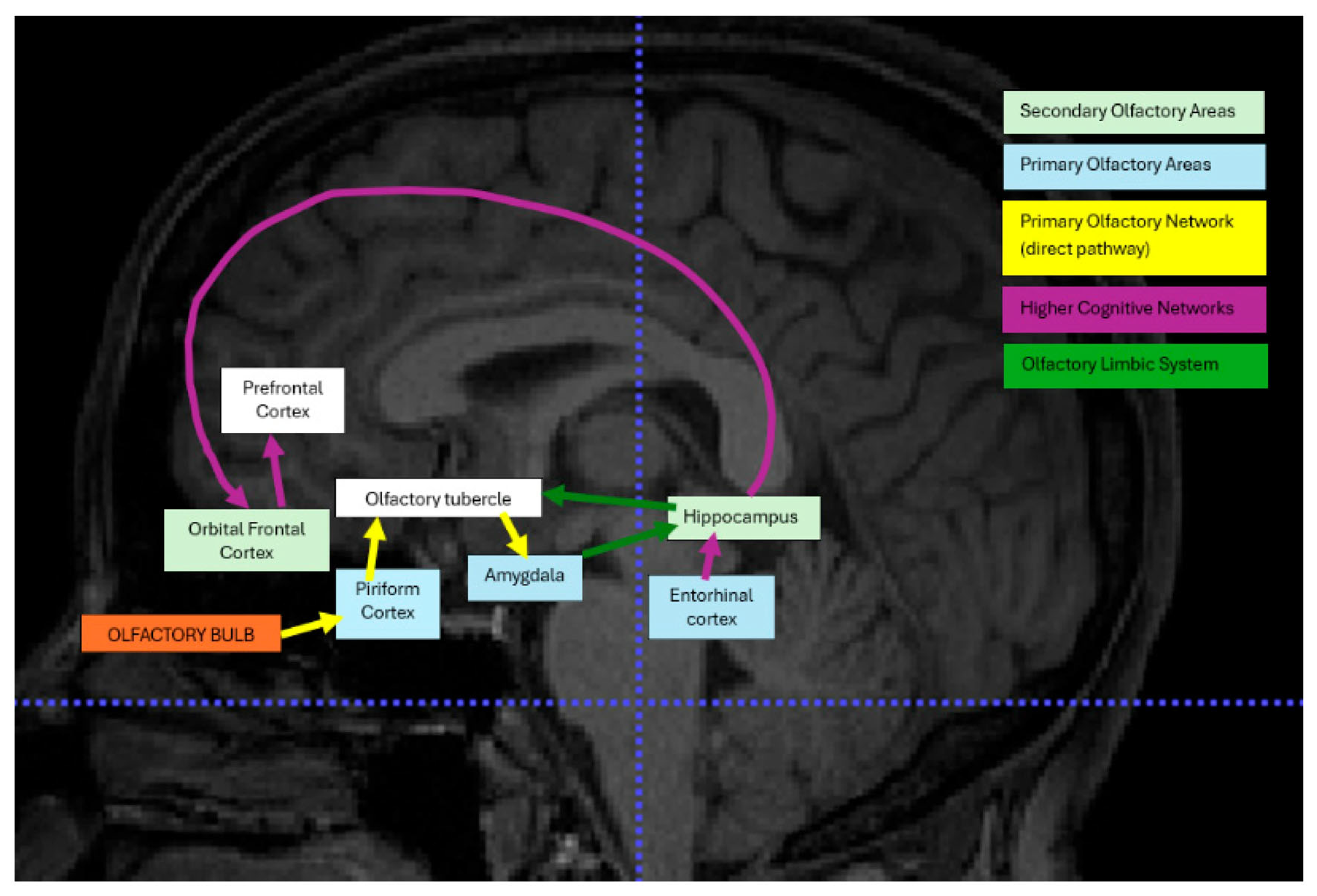 Brainsci 15 00690 g002