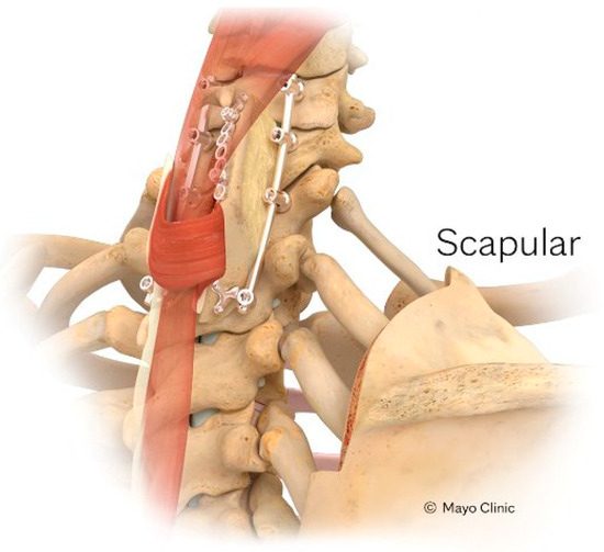 脊椎脊髄の手術 = Illustrated Surgery of Spine … 三輪書店オンラインショップ / 脊椎脊髄の手術 Illustrated
