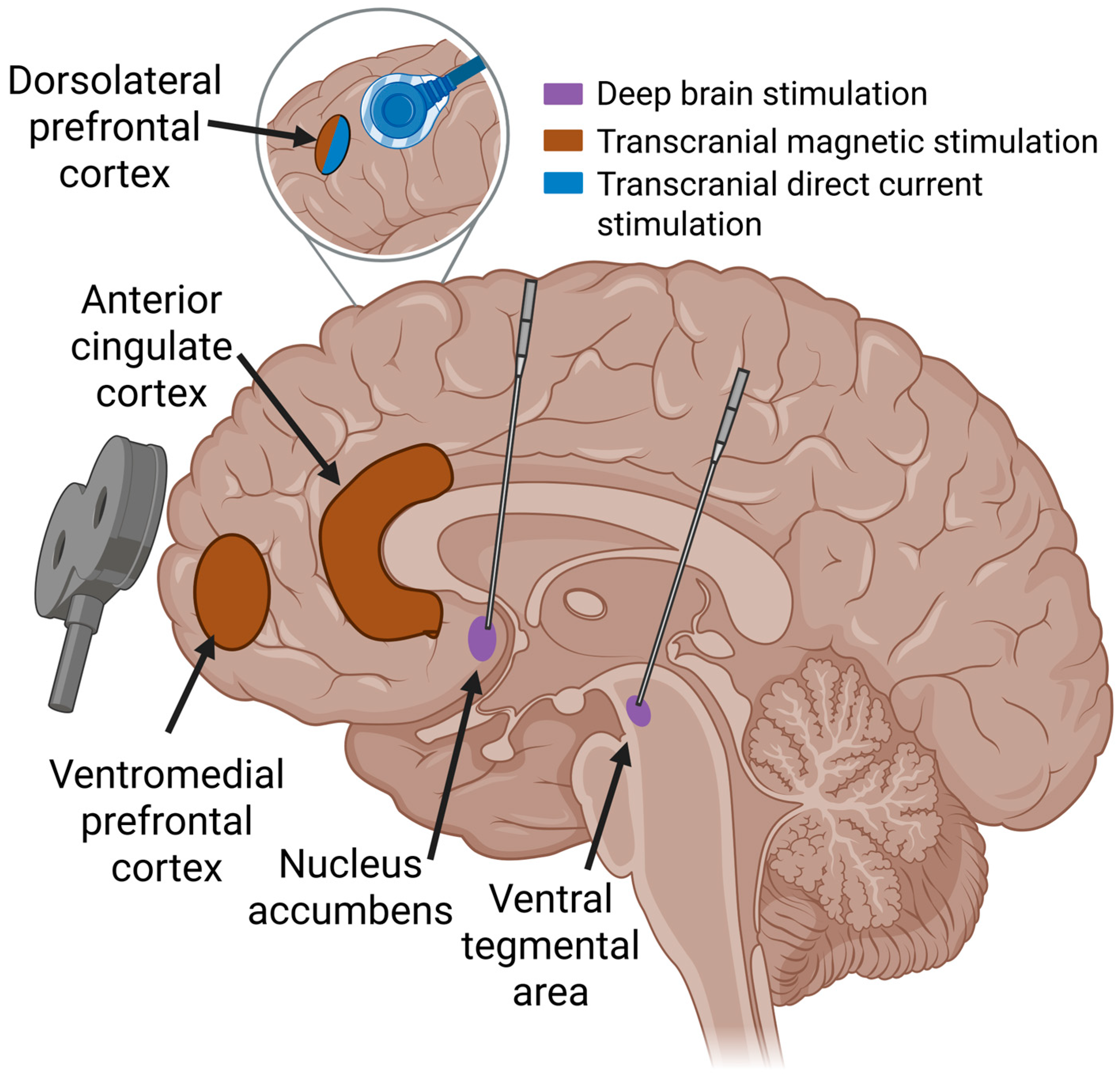 Brainsci 15 00723 g001