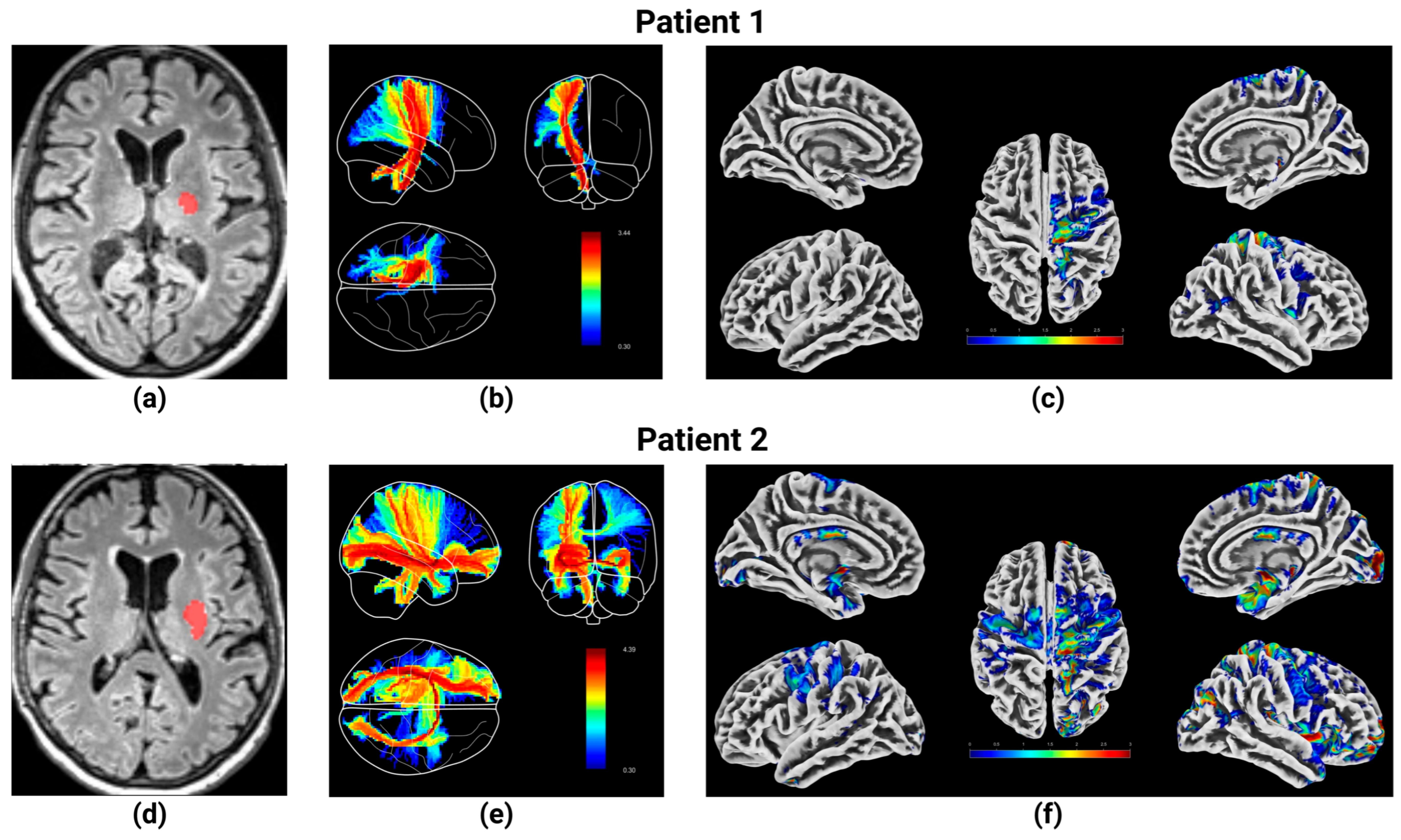 Brainsci 15 00735 g004