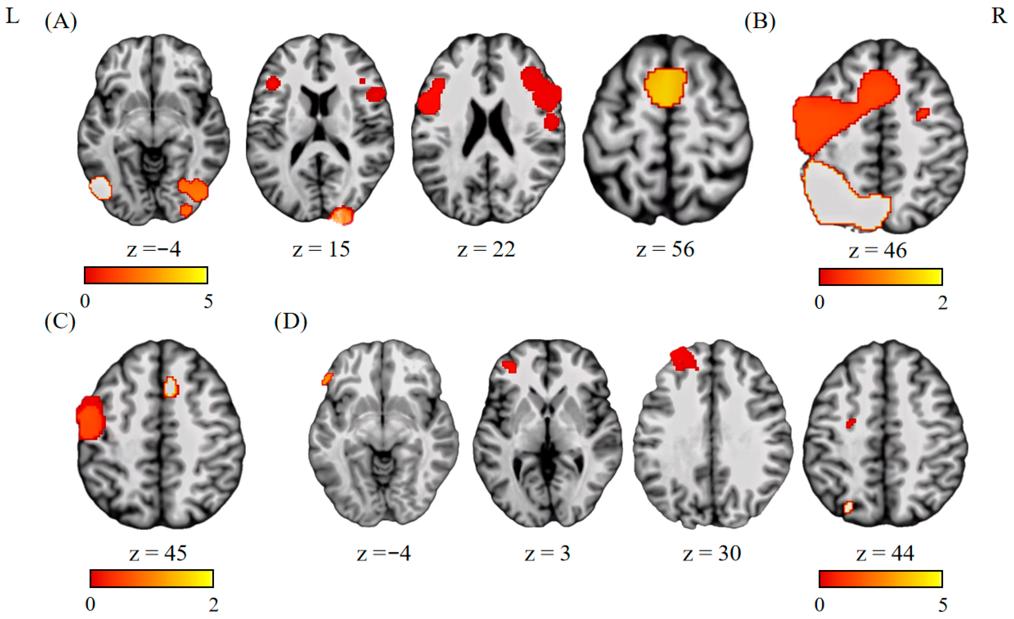 Brainsci 15 00803 g002 Brainsci 15 00803 g002