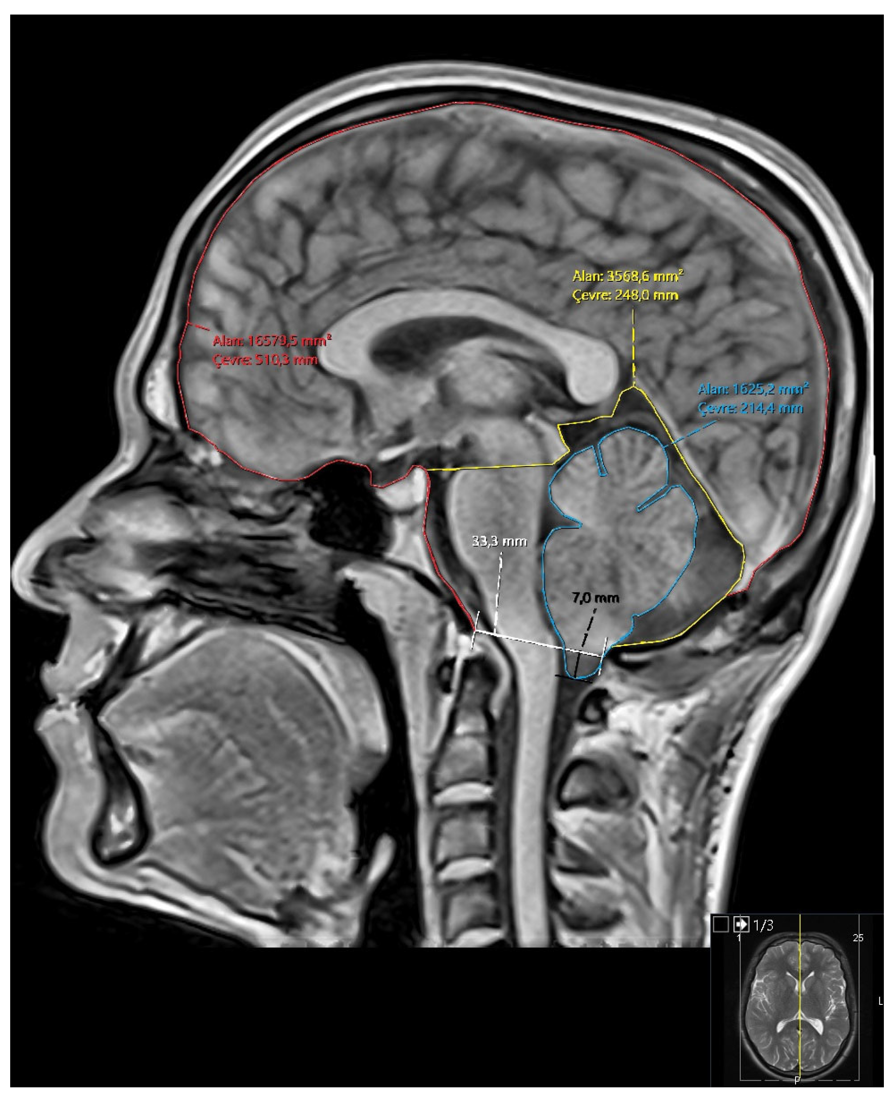 Brainsci 15 00811 g001