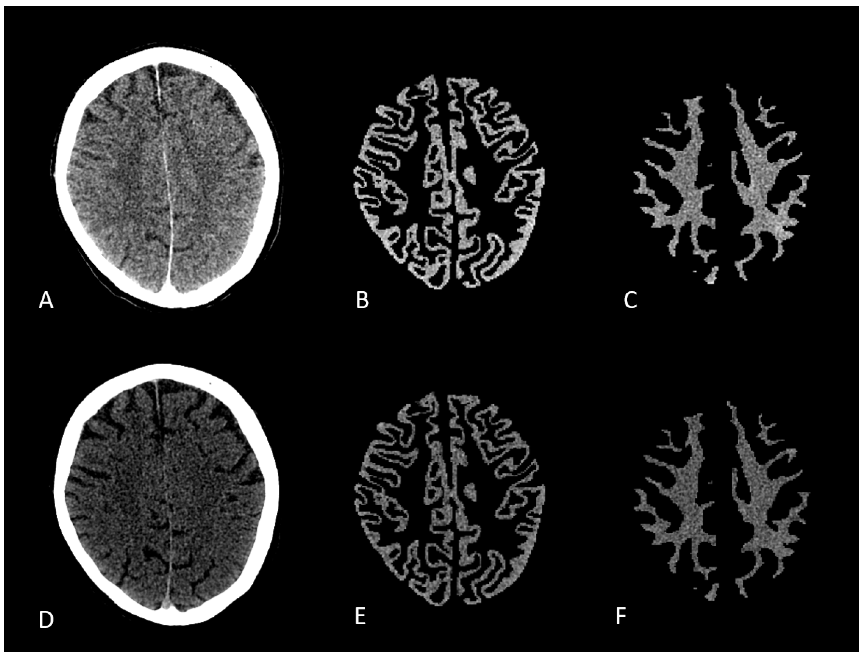 Brainsci 15 00821 g001