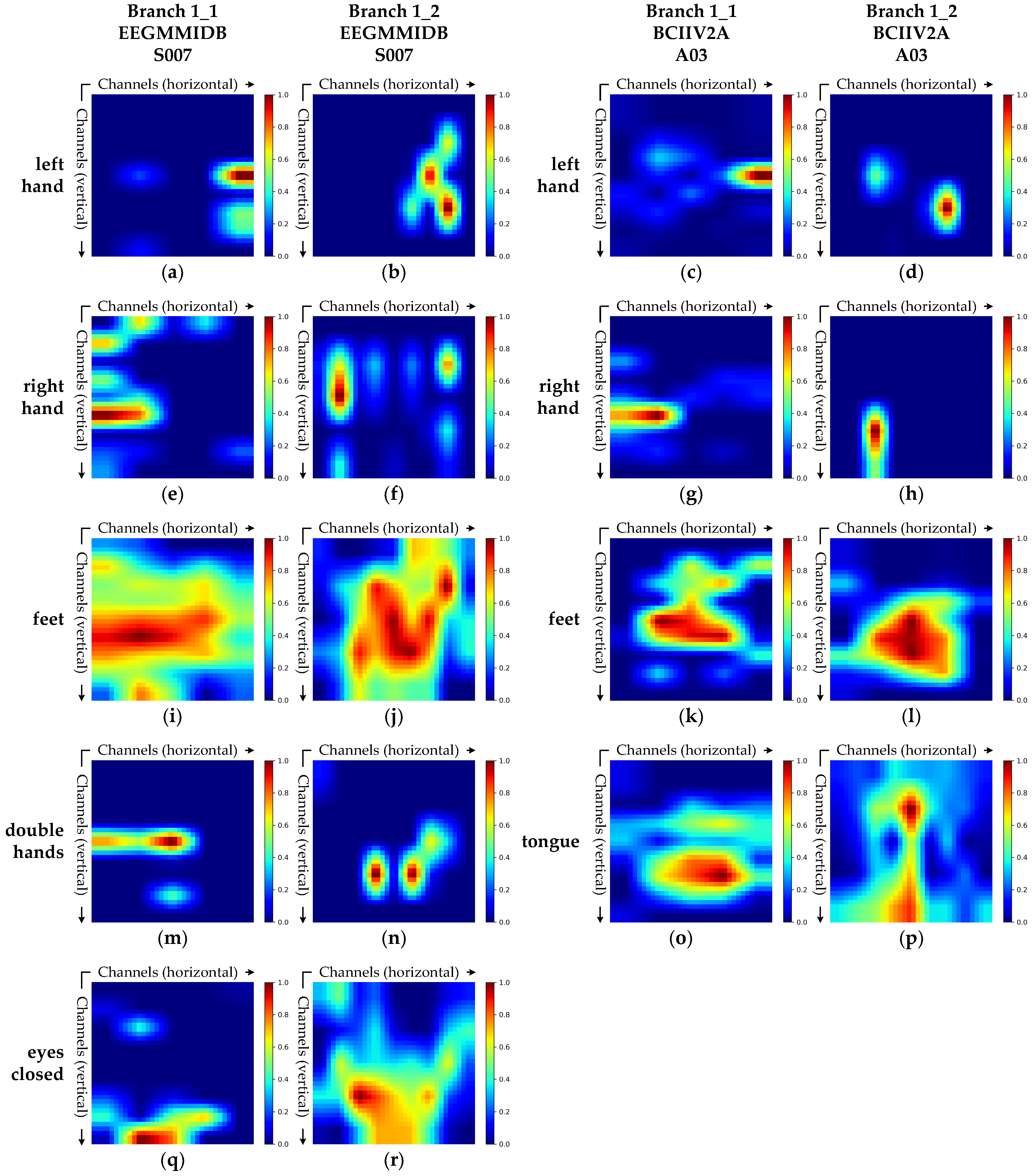 Brainsci 15 00877 g007 Brainsci 15 00877 g007