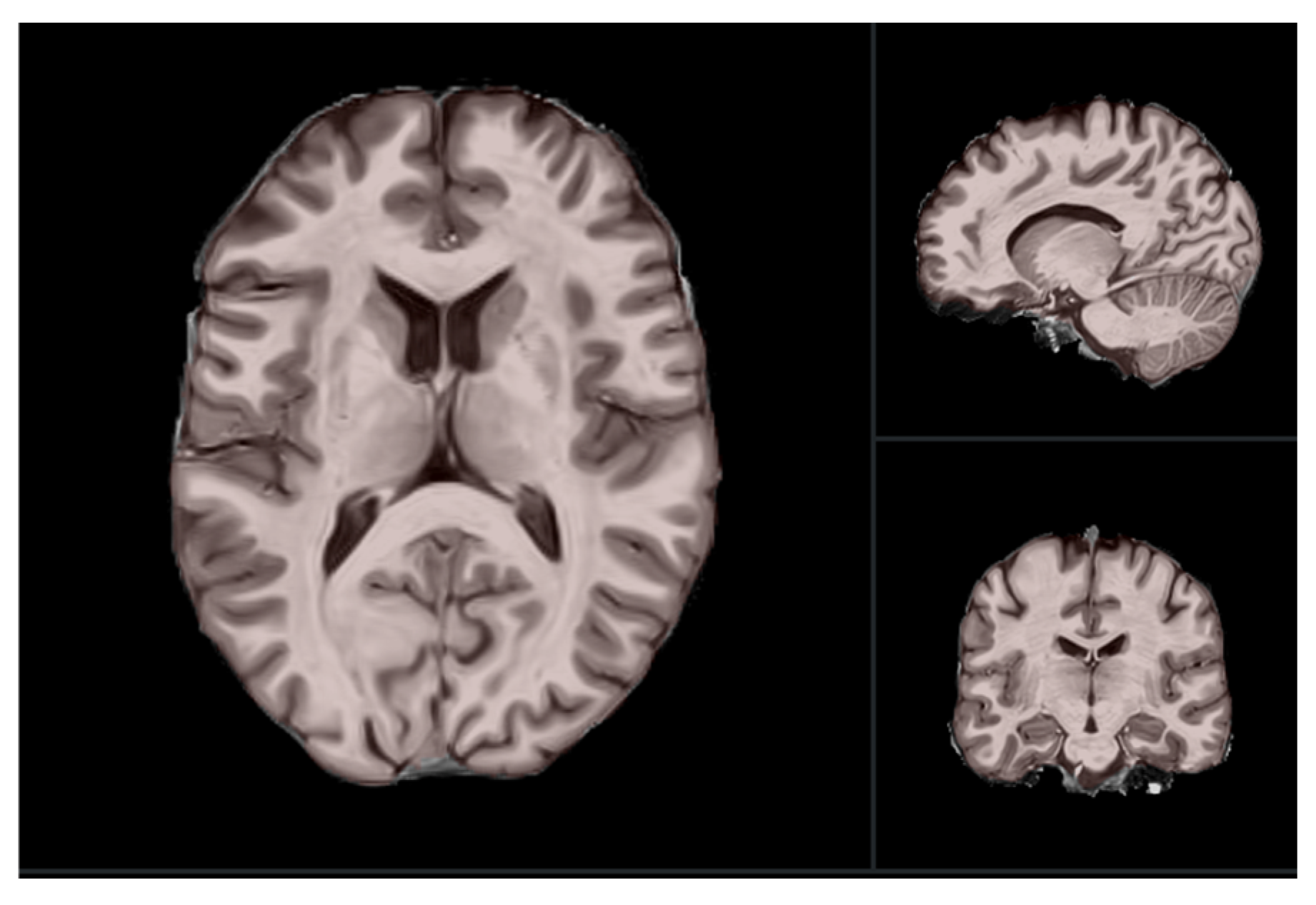 Brainsci 15 00914 g001