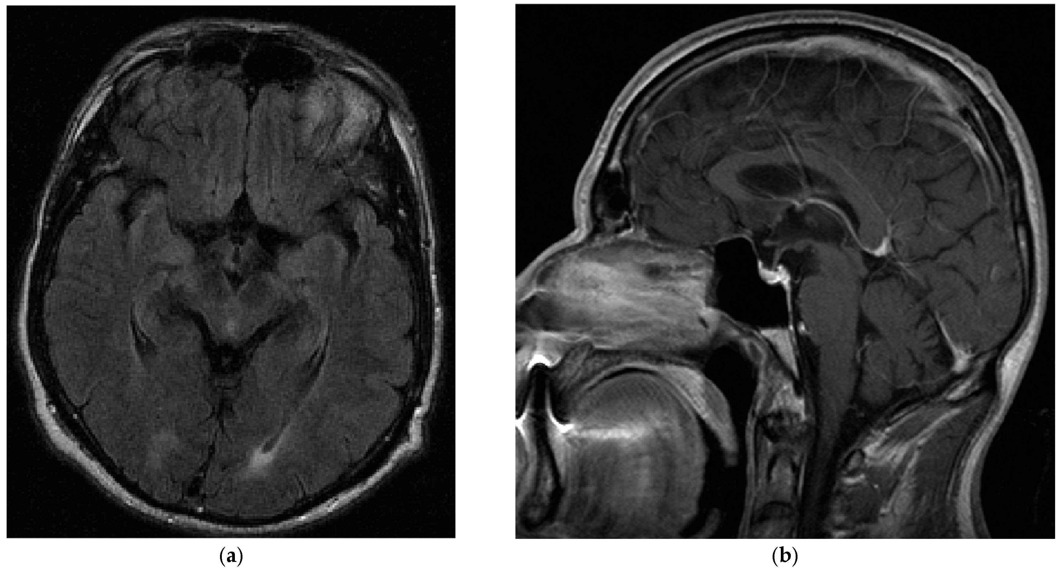 Brainsci 15 00921 g002