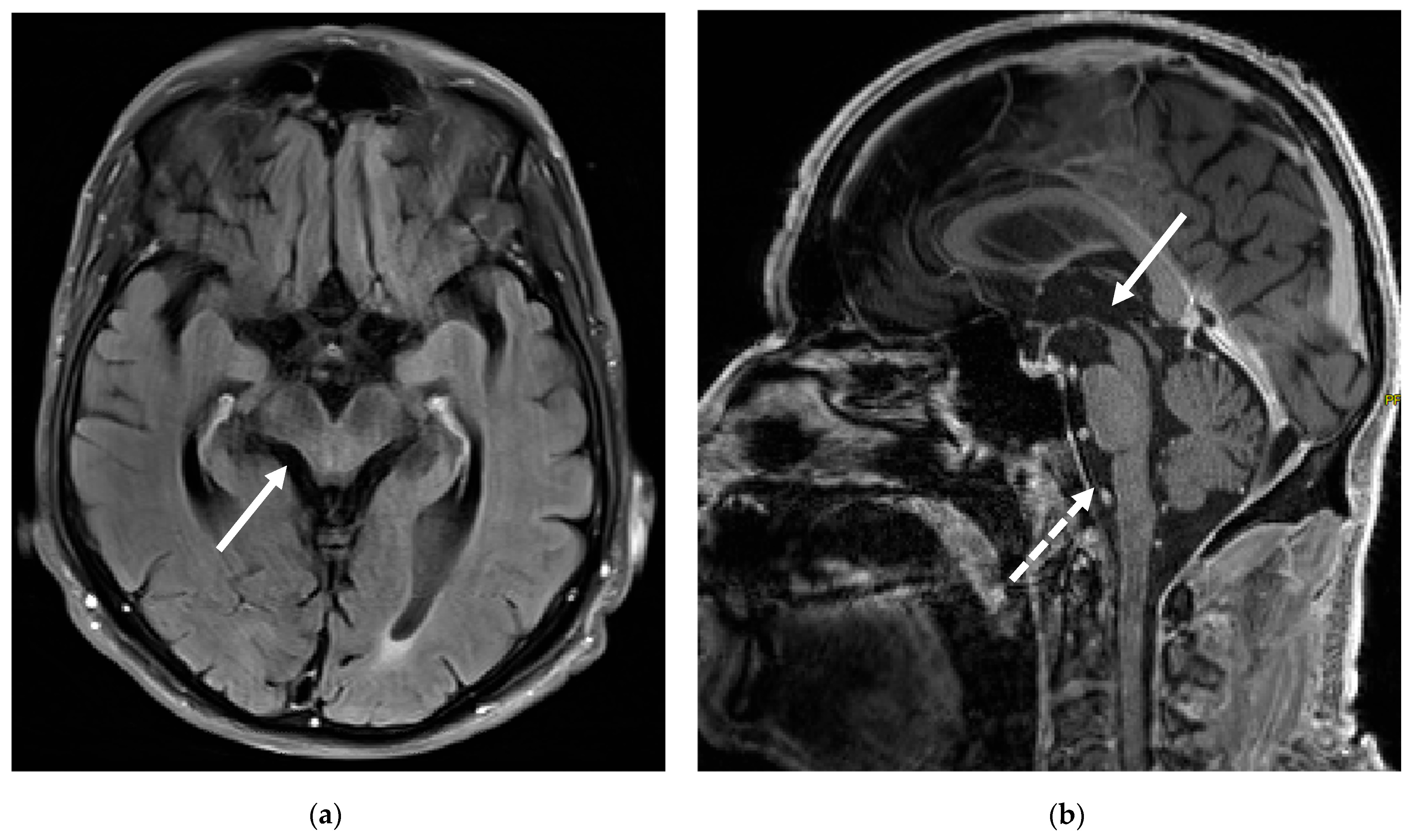 Brainsci 15 00921 g003