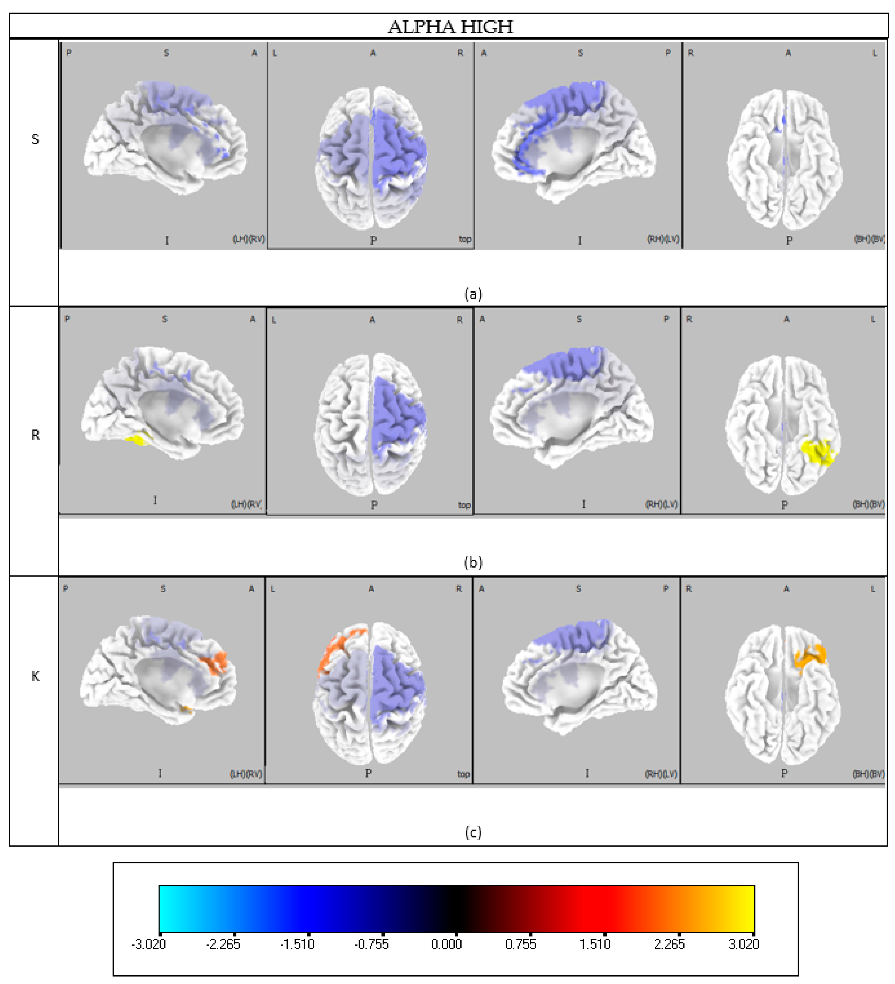 Brainsci 15 00981 g0a2