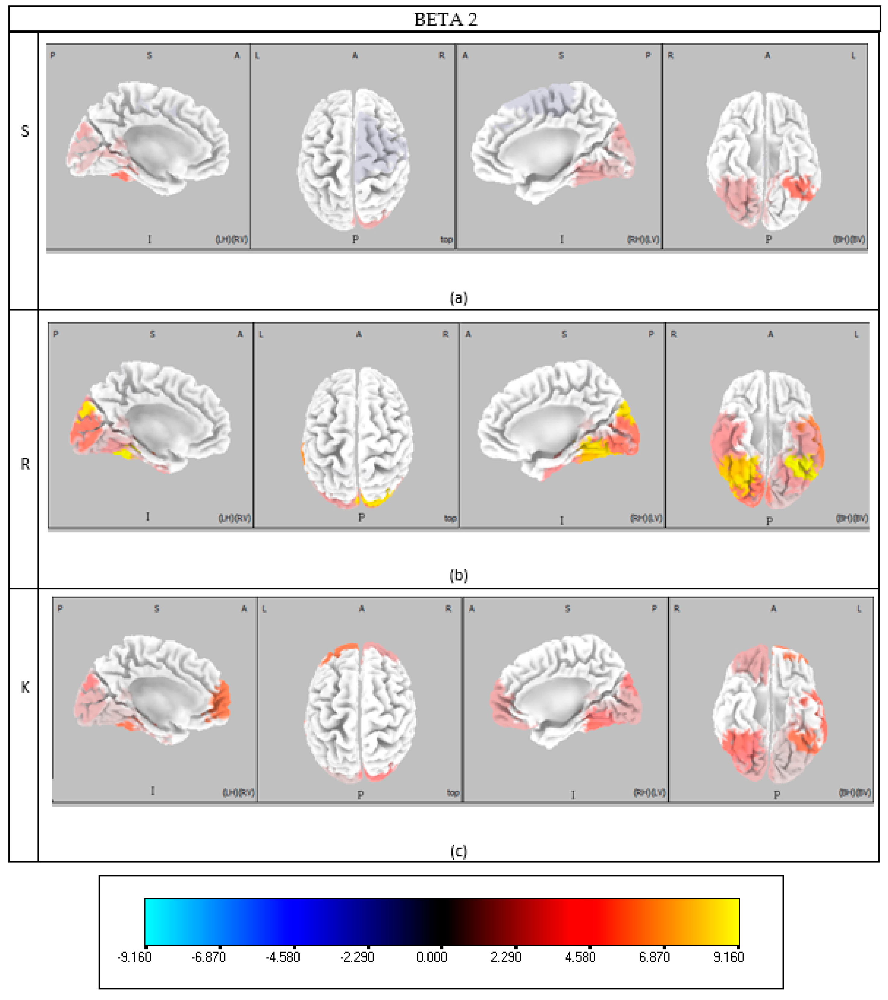 Brainsci 15 00981 g0a4