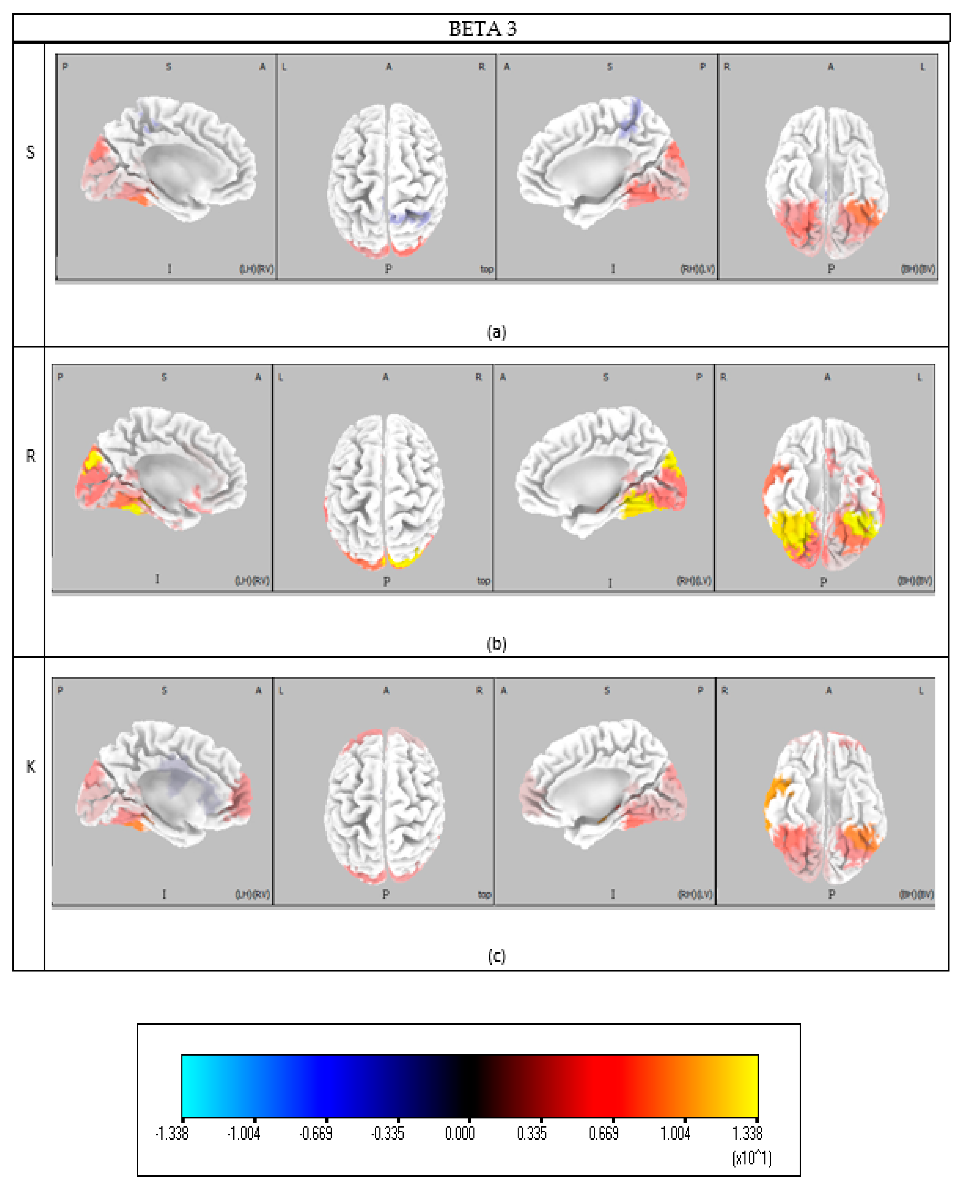 Brainsci 15 00981 g0a5