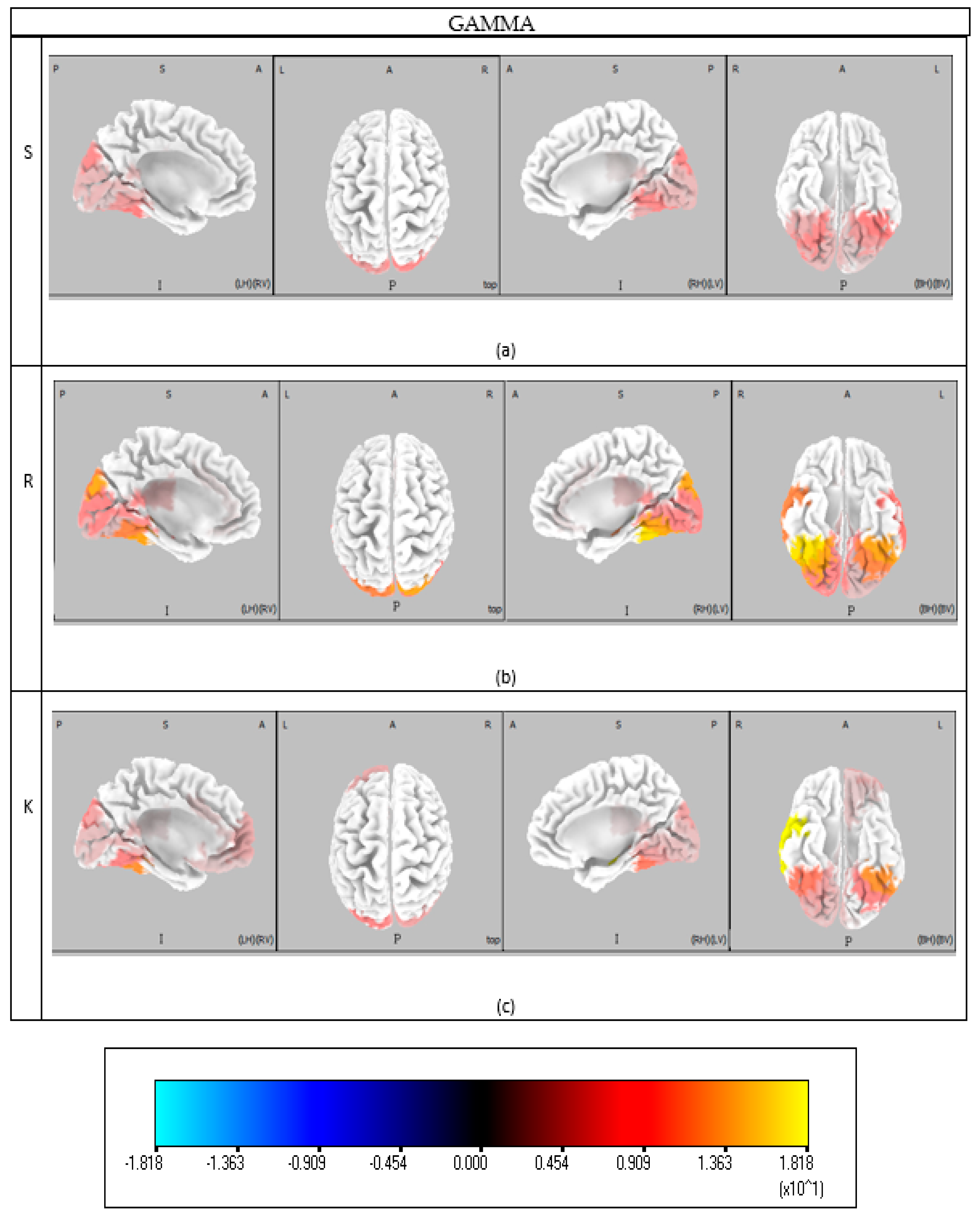 Brainsci 15 00981 g0a6